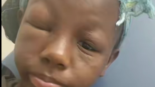 Help Keniyah Lewis Get Urgent Eye Surgery photo