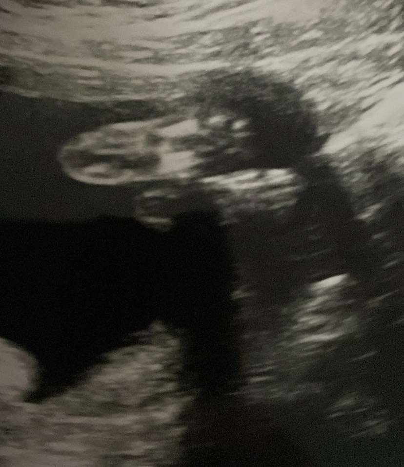 Support a Young Couple Through Tragic Loss Of Daughter campaign photo, 2 of 4