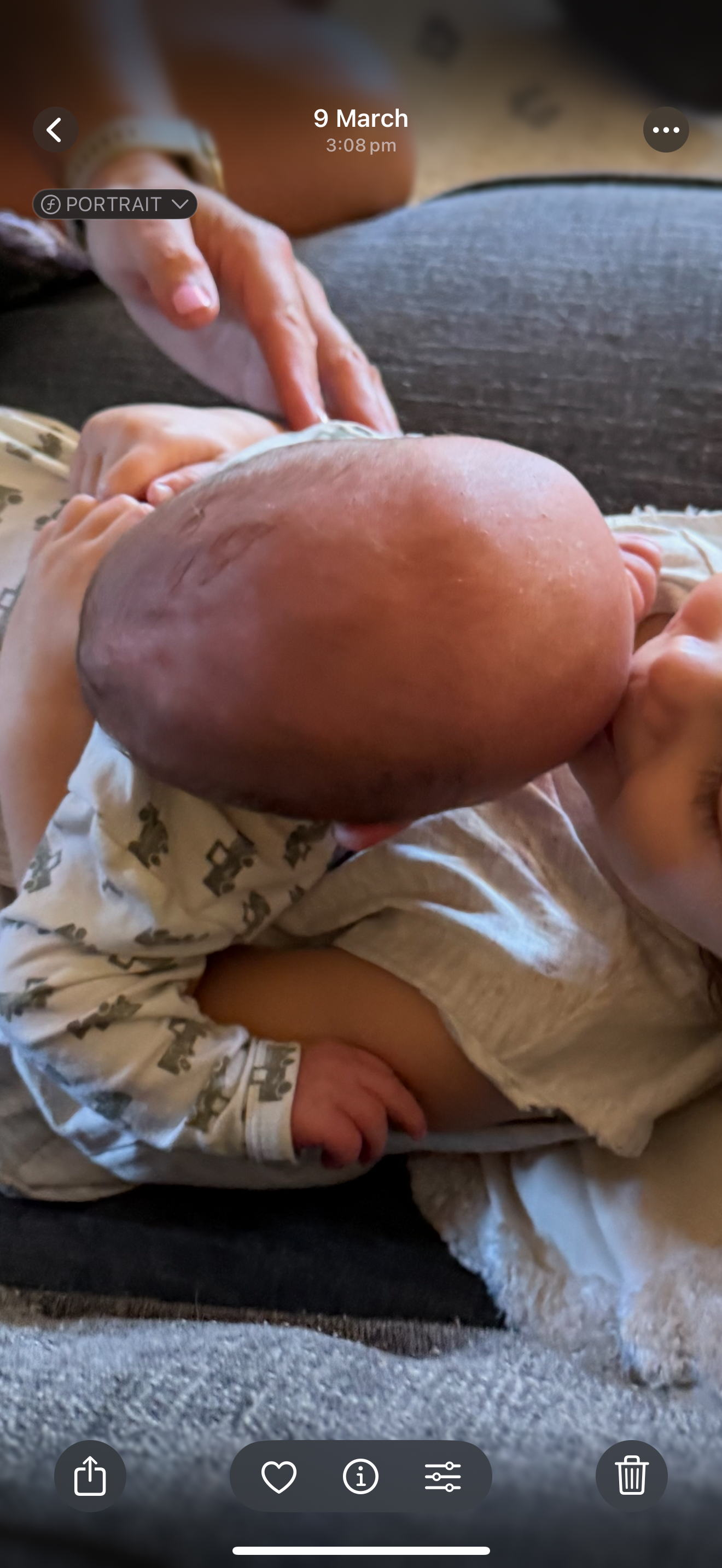 “Hope, Healing, and Heart, Casey’s Craniosynostosis Surgery campaign photo, 2 of 8