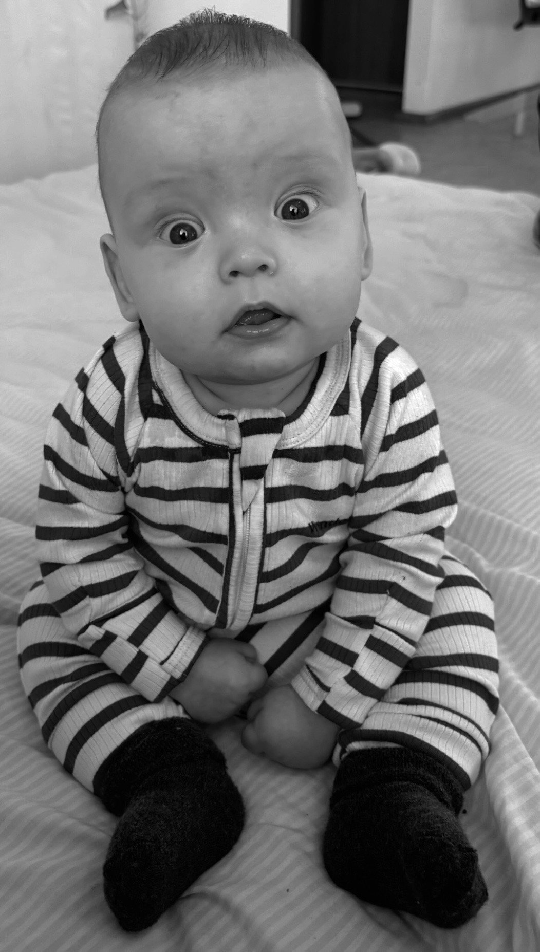 “Hope, Healing, and Heart, Casey’s Craniosynostosis Surgery campaign photo, 5 of 8