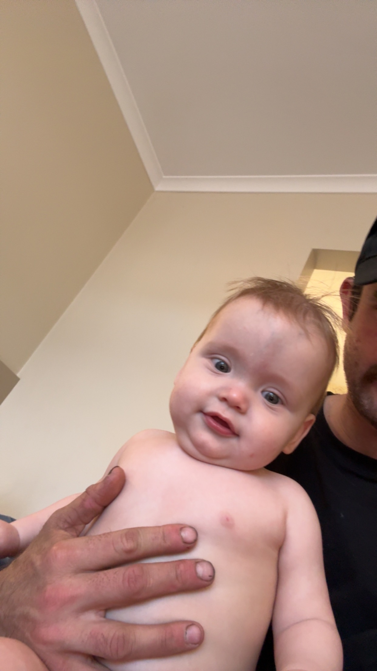 “Hope, Healing, and Heart, Casey’s Craniosynostosis Surgery campaign photo, 6 of 8