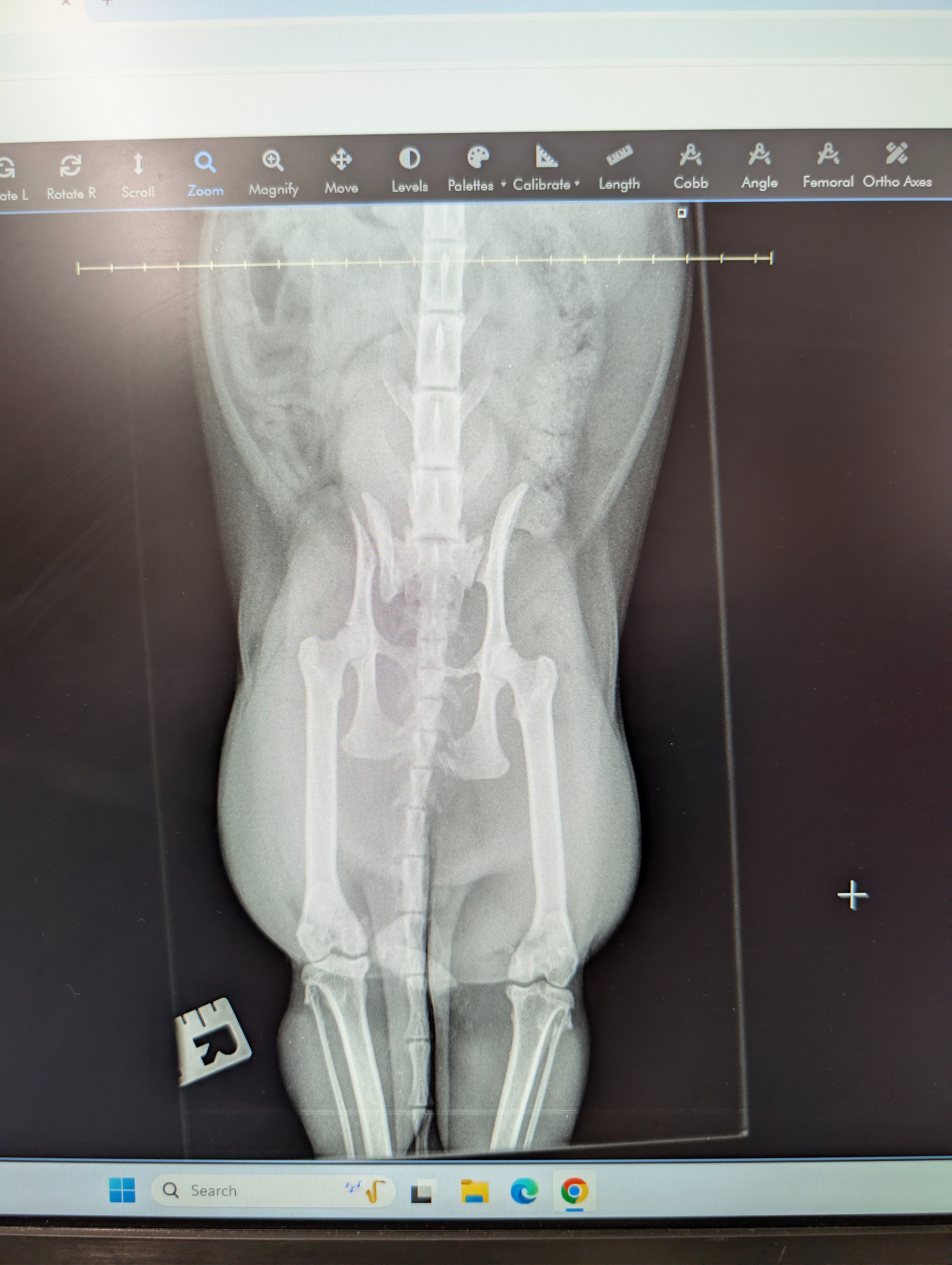 Leo's orthopaedic surgery campaign photo, 2 of 8