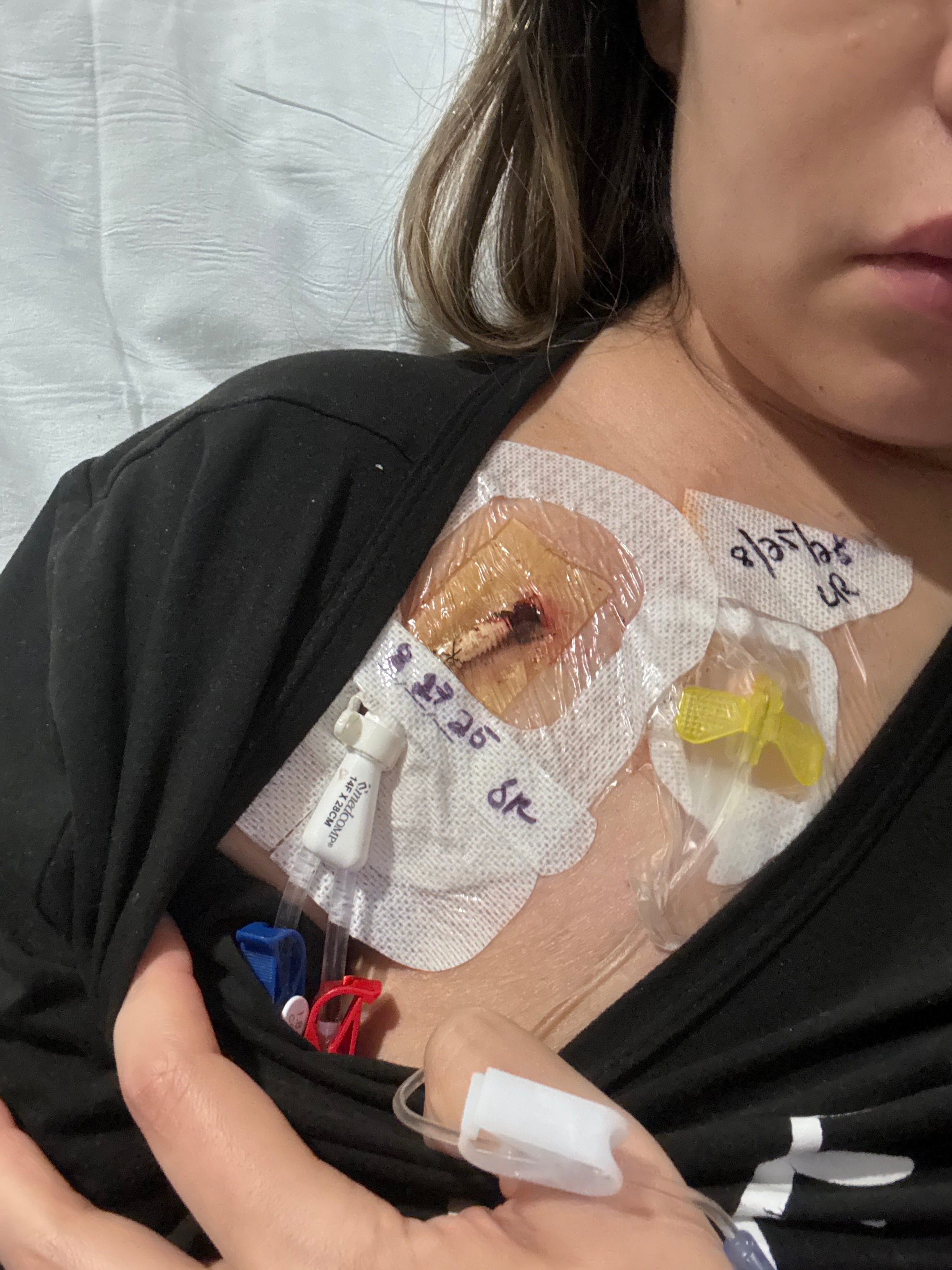Support Michie's Kidney Transplant Journey campaign photo, 6 of 7