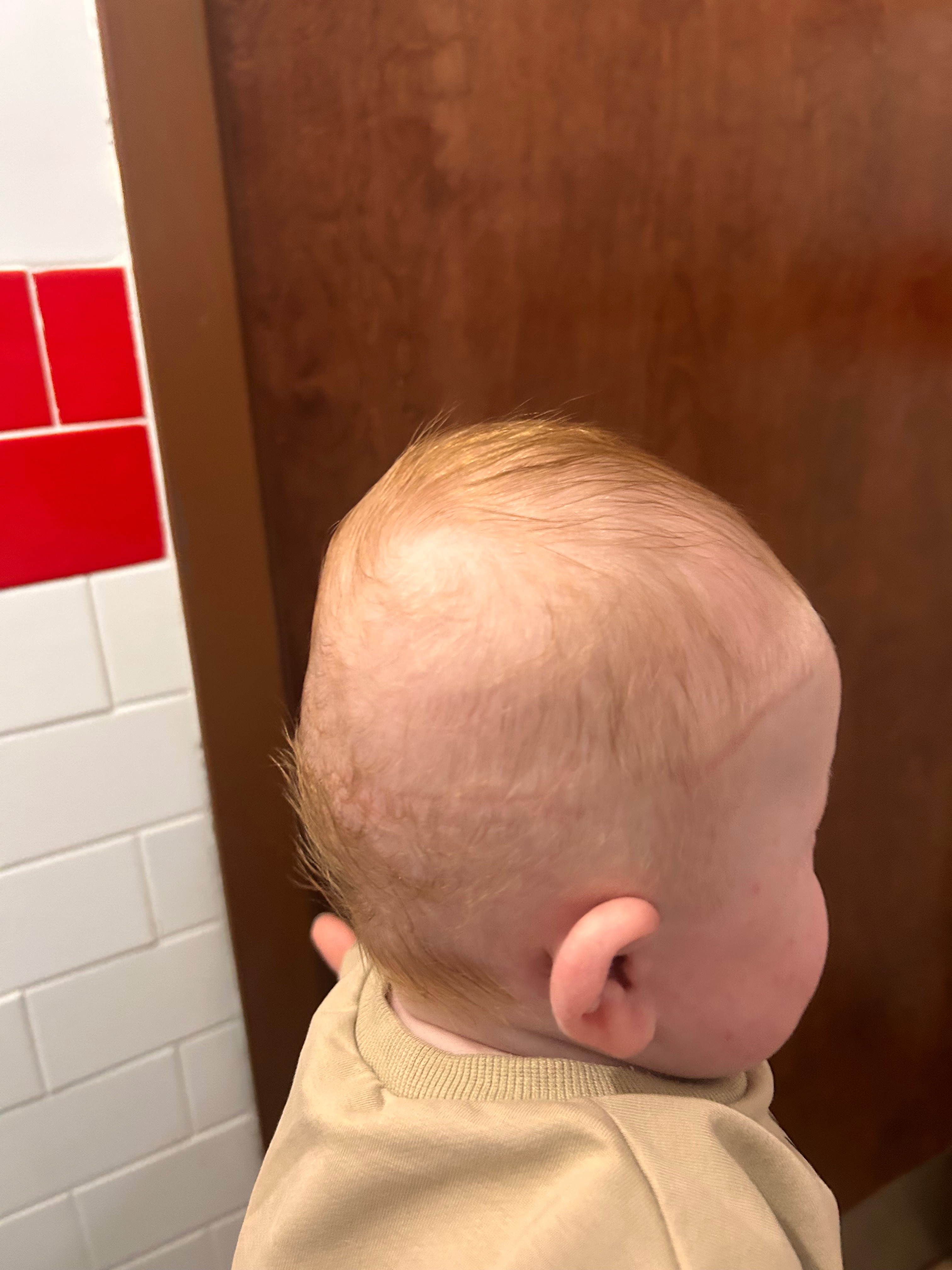 Help Ryker Lynn Fast Get His Helmet campaign photo, 2 of 8