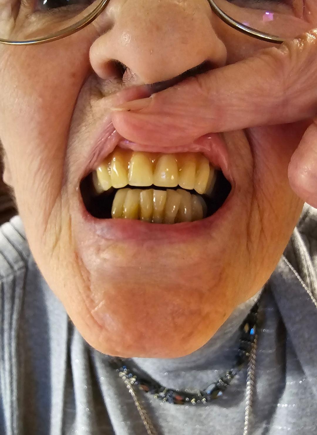 Help Support Sondra's Essential Dental Surgery campaign photo, 4 of 5