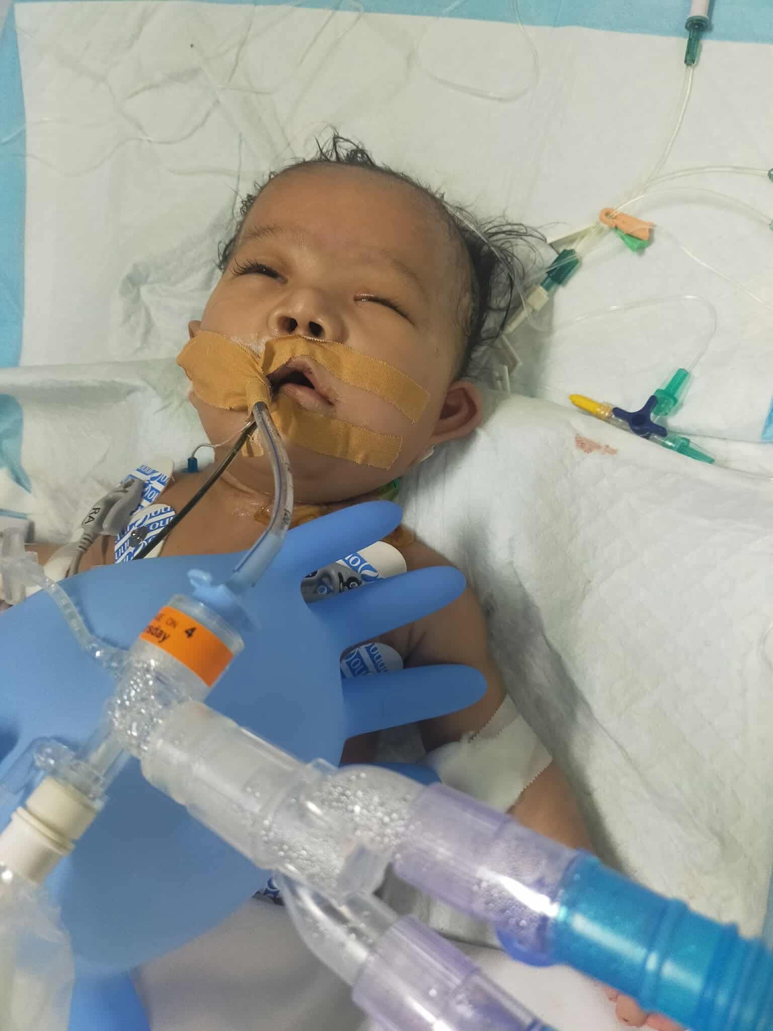 Help Baby Potpot Continue Her Journey at Home campaign photo, 7 of 8