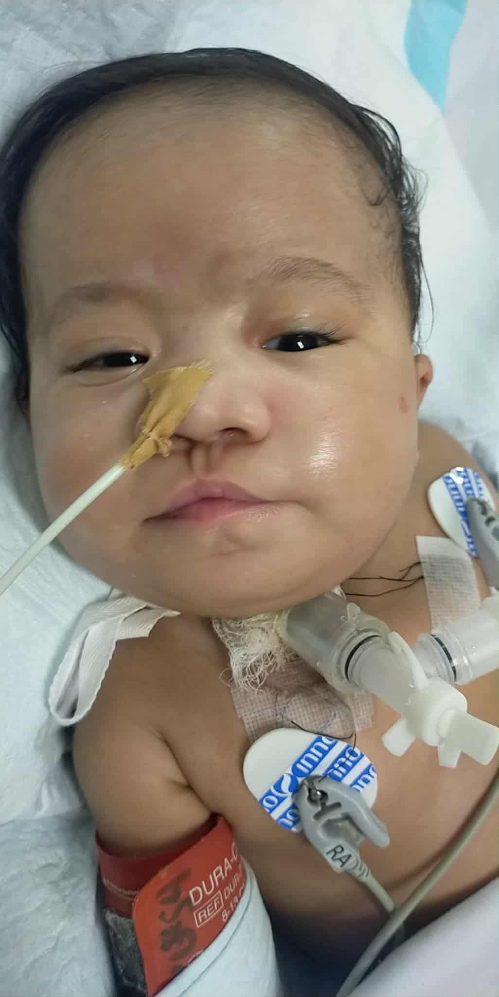 Help Baby Potpot Continue Her Journey at Home campaign photo, 5 of 8