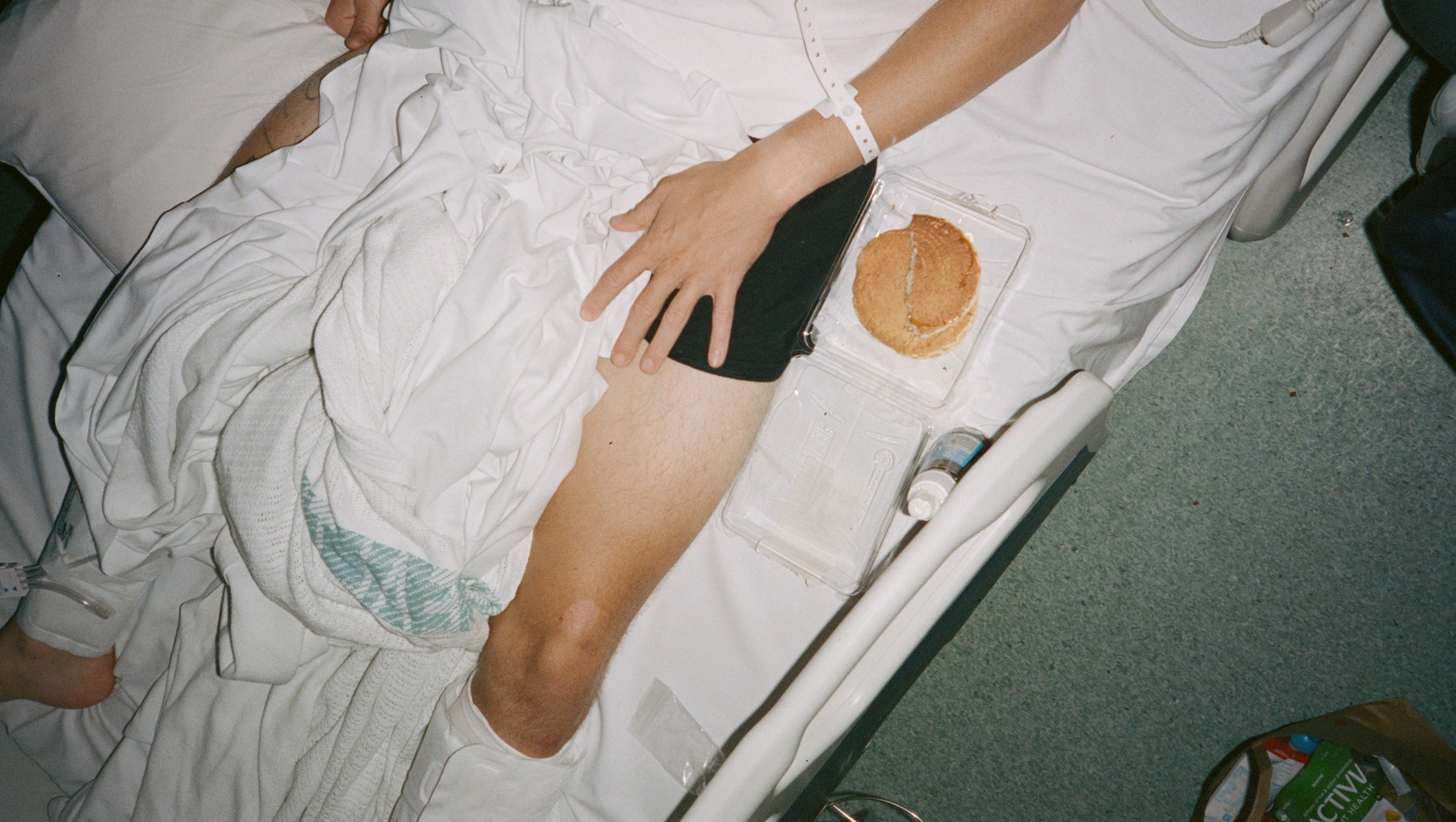 SnakeBaby broken femur surgery cover