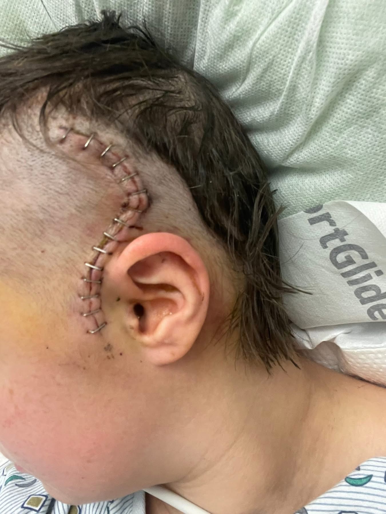 Support Chloe's Recovery from Brain Surgeries campaign photo, 6 of 6
