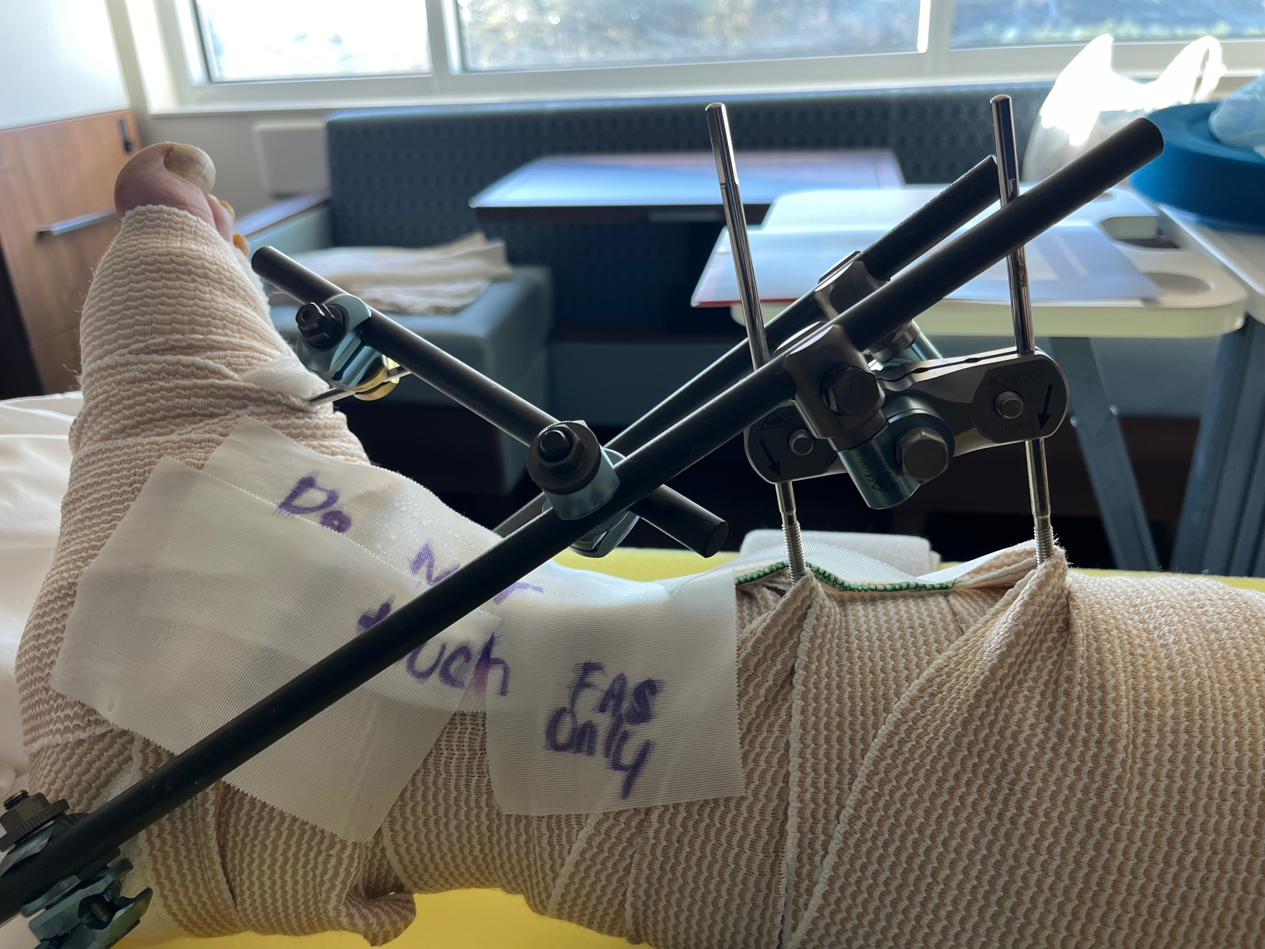 Support Rick's Recovery After Ankle Surgery campaign photo, 5 of 8
