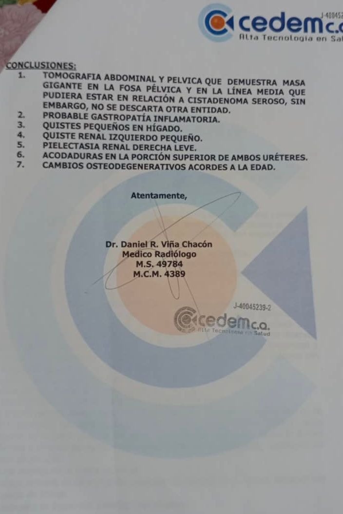 Tumoración gigante de ovario derecho campaign photo, 2 of 8