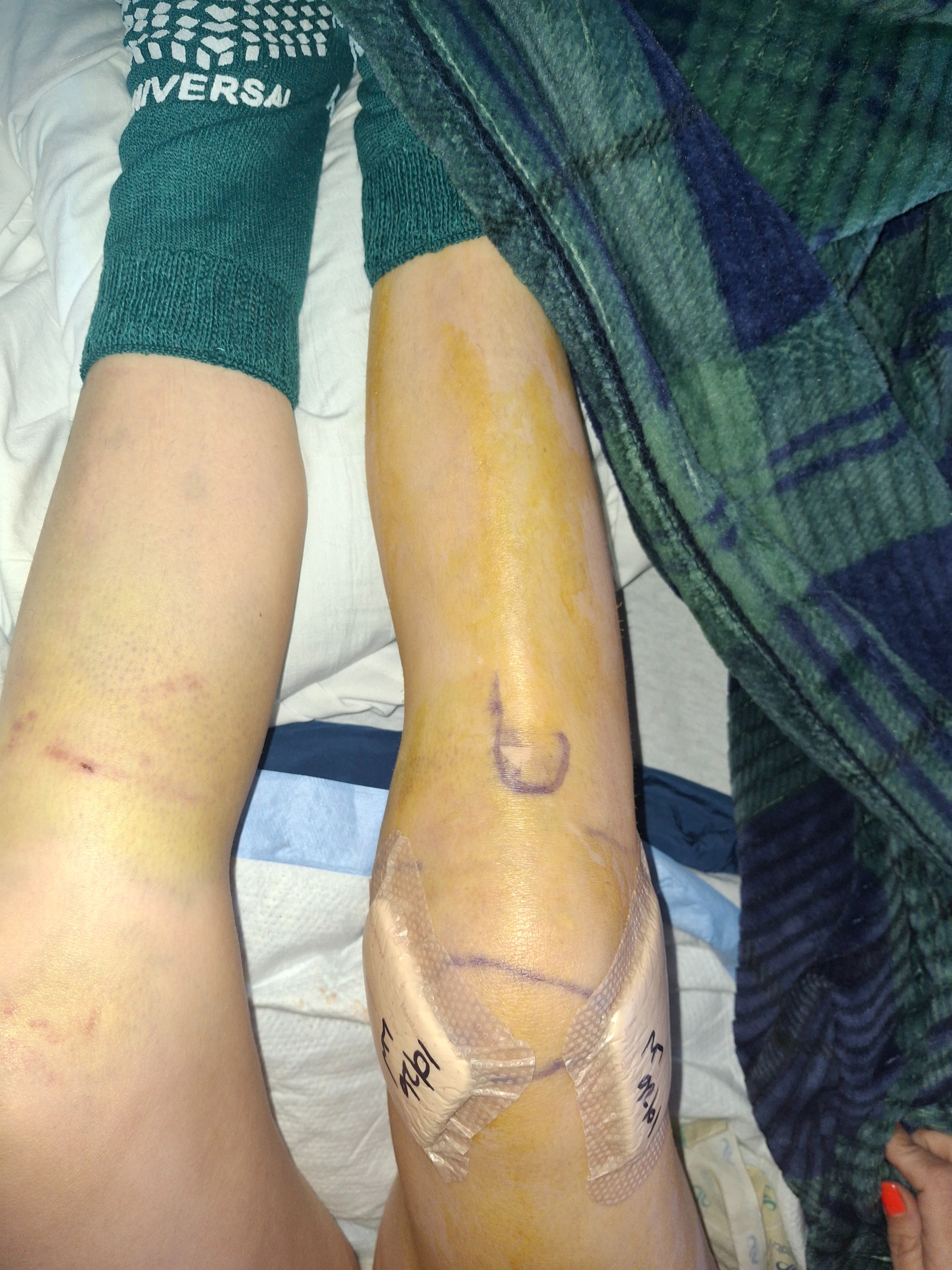 Support Dakota's Recovery After Car Wreck campaign photo, 4 of 5