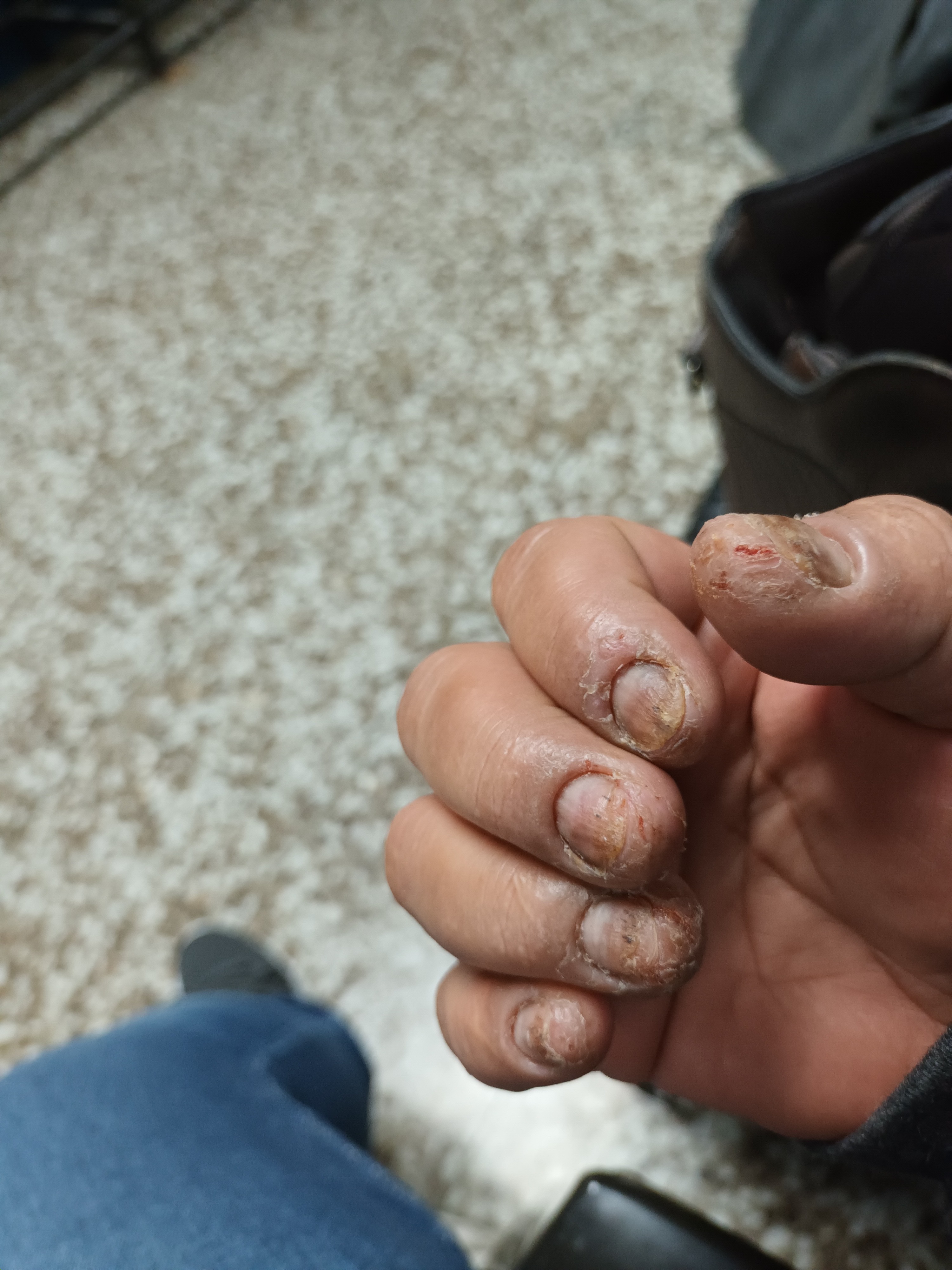 Help a Family in Guatemala Survive After Losing Everything campaign photo, 5 of 8