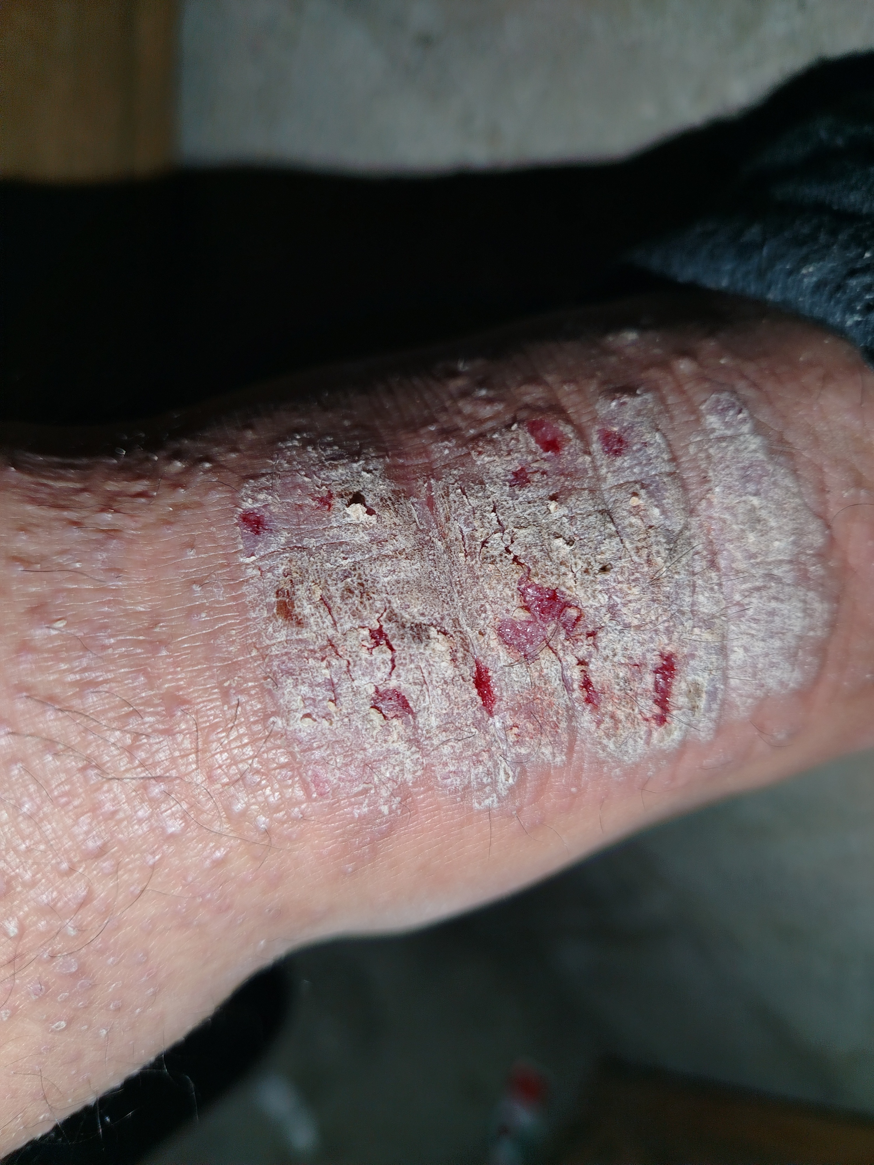 Help a Family in Guatemala Survive After Losing Everything campaign photo, 6 of 8