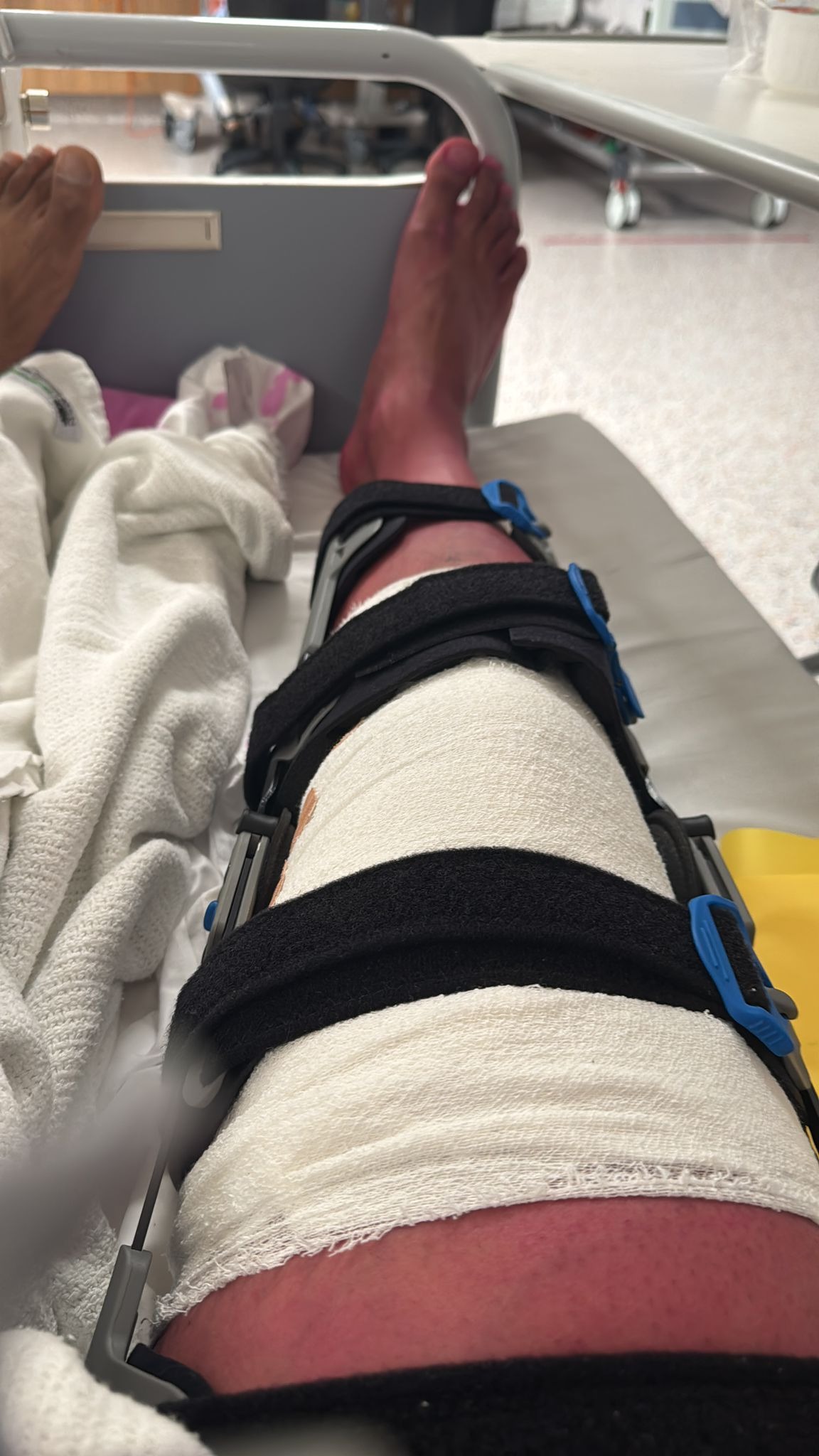 Leg Small Injury Fundraiser by Sharriff Rahman : Leg Injury - Temporary Relief