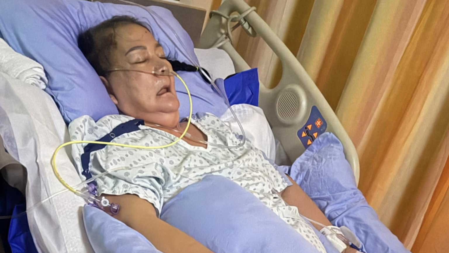 Help Lydia Revivis's Brain Aneurysm recovery photo