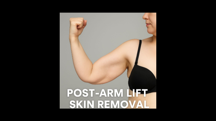 Help for painfree life through surgery photo