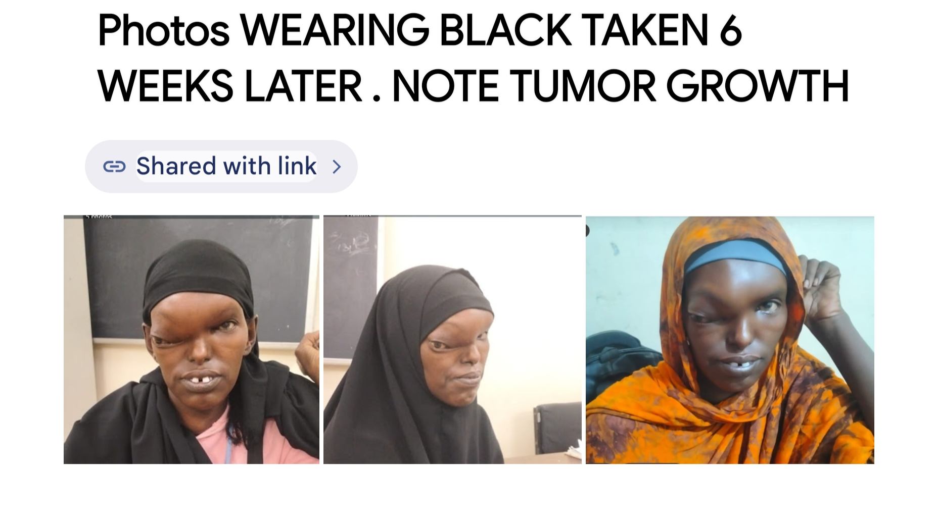 Save Hawa: Urgent Cancer Treatment Needed