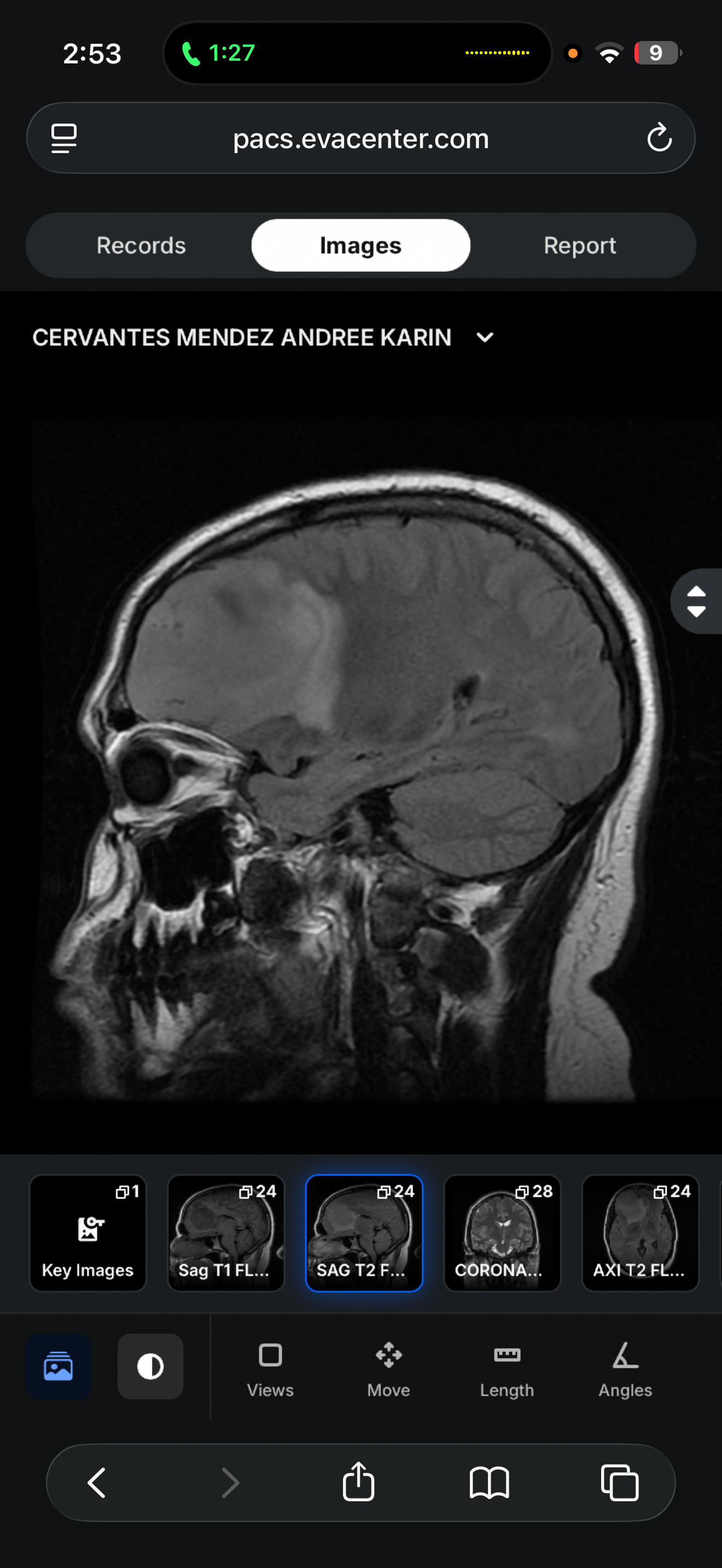 Apoyo para mi operación de tumor cerebral y tratamiento campaign photo, 2 of 6