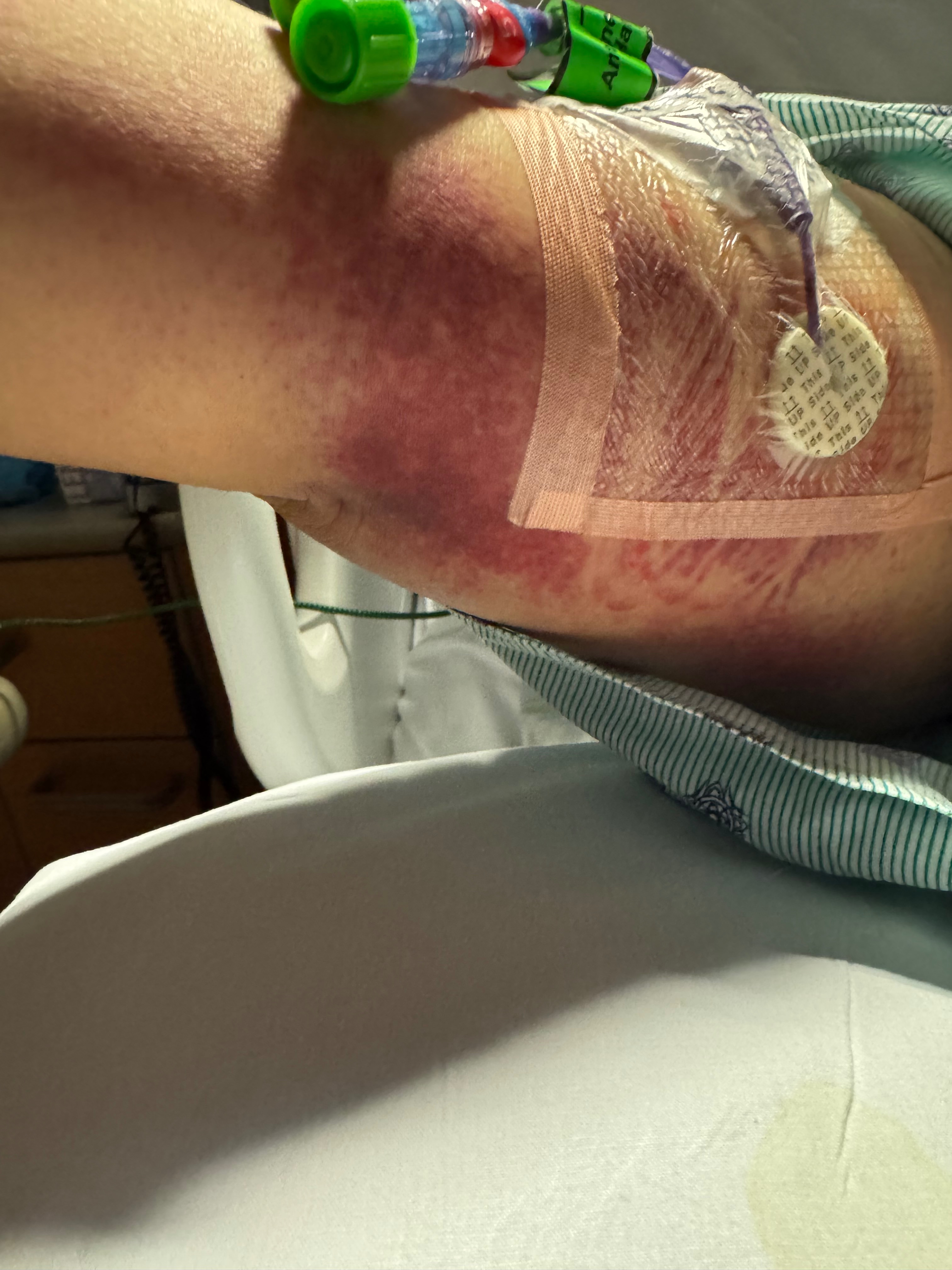 Support Ann's Battle Against Acute Leukemia campaign photo, 2 of 8
