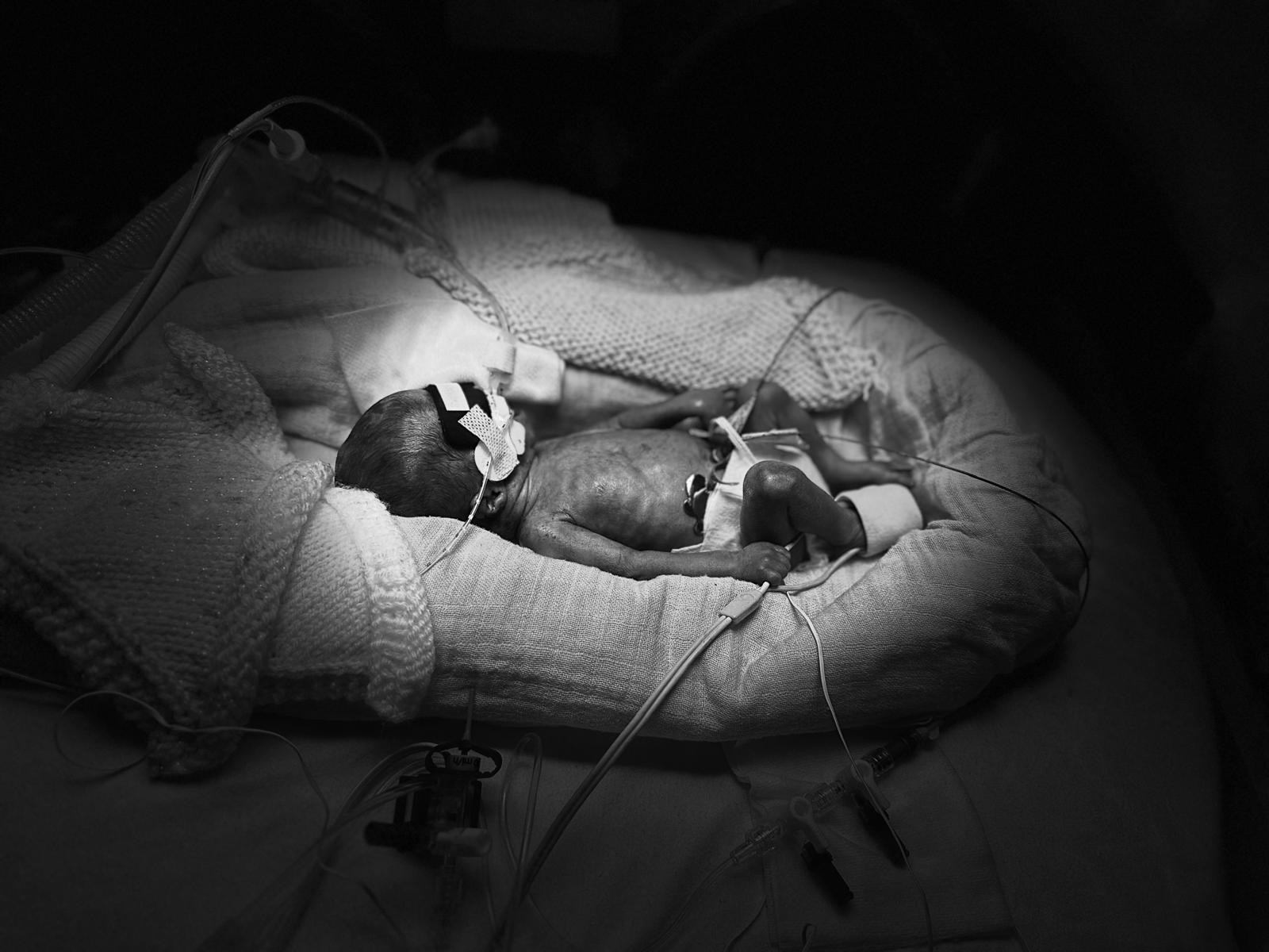 Ramona and her premature twins. campaign photo, 7 of 8
