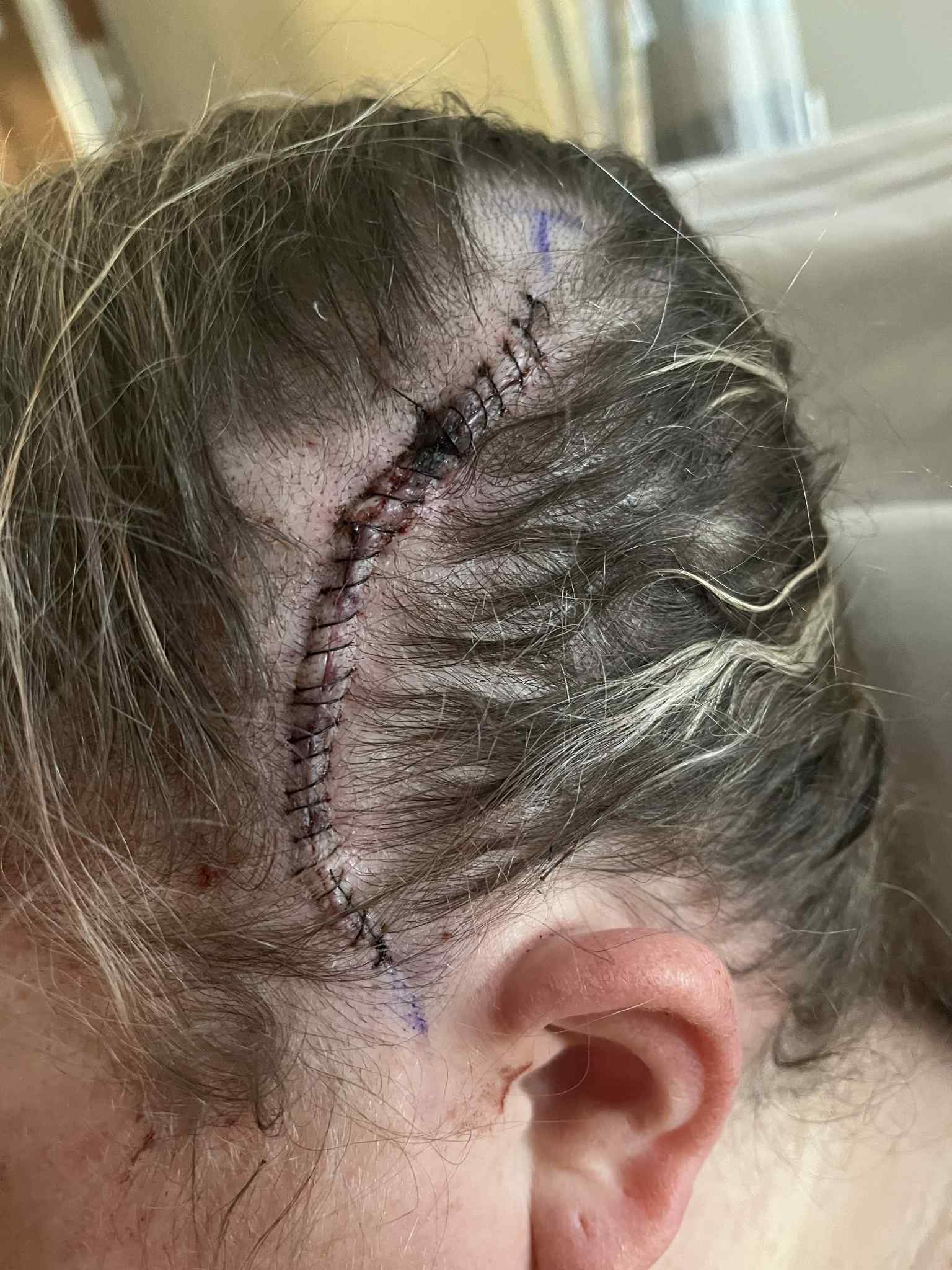 Help Jenna Ellis Through Her Healing Journey campaign photo, 2 of 5