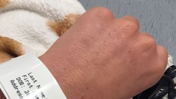 Need help towards private tests due to agonising pain await photo