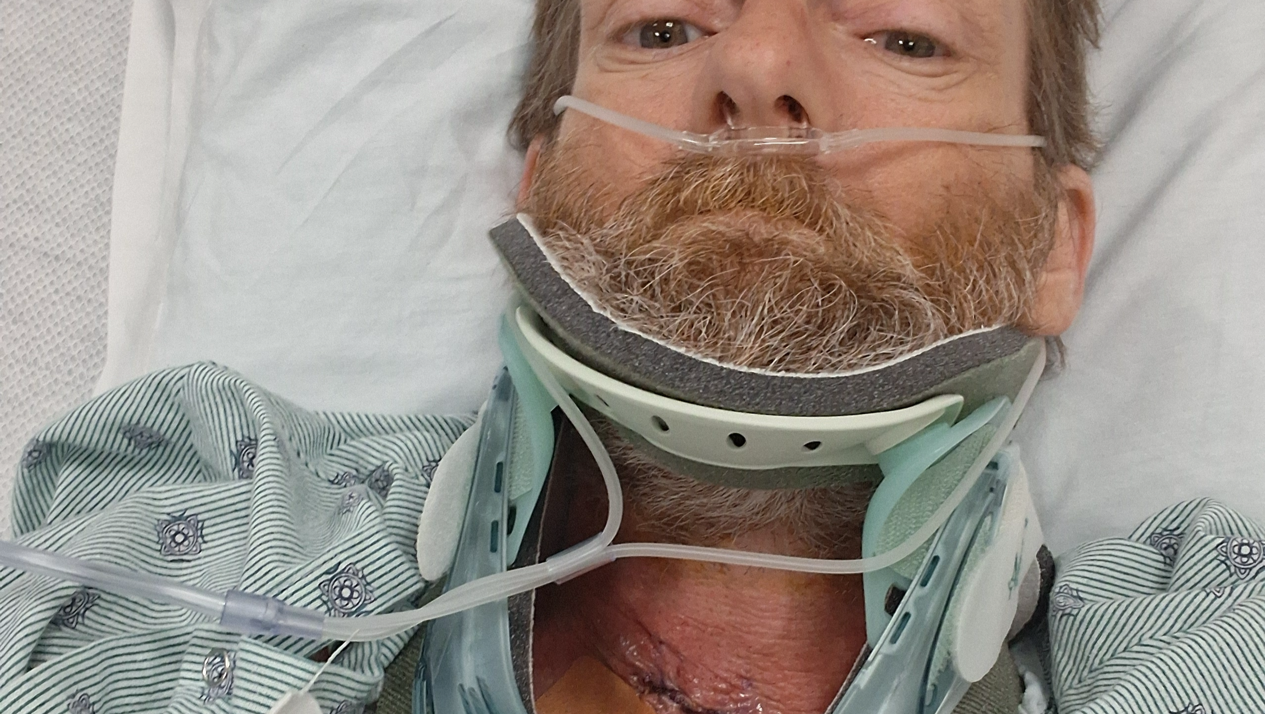 Support Recovery After Spine Surgery photo