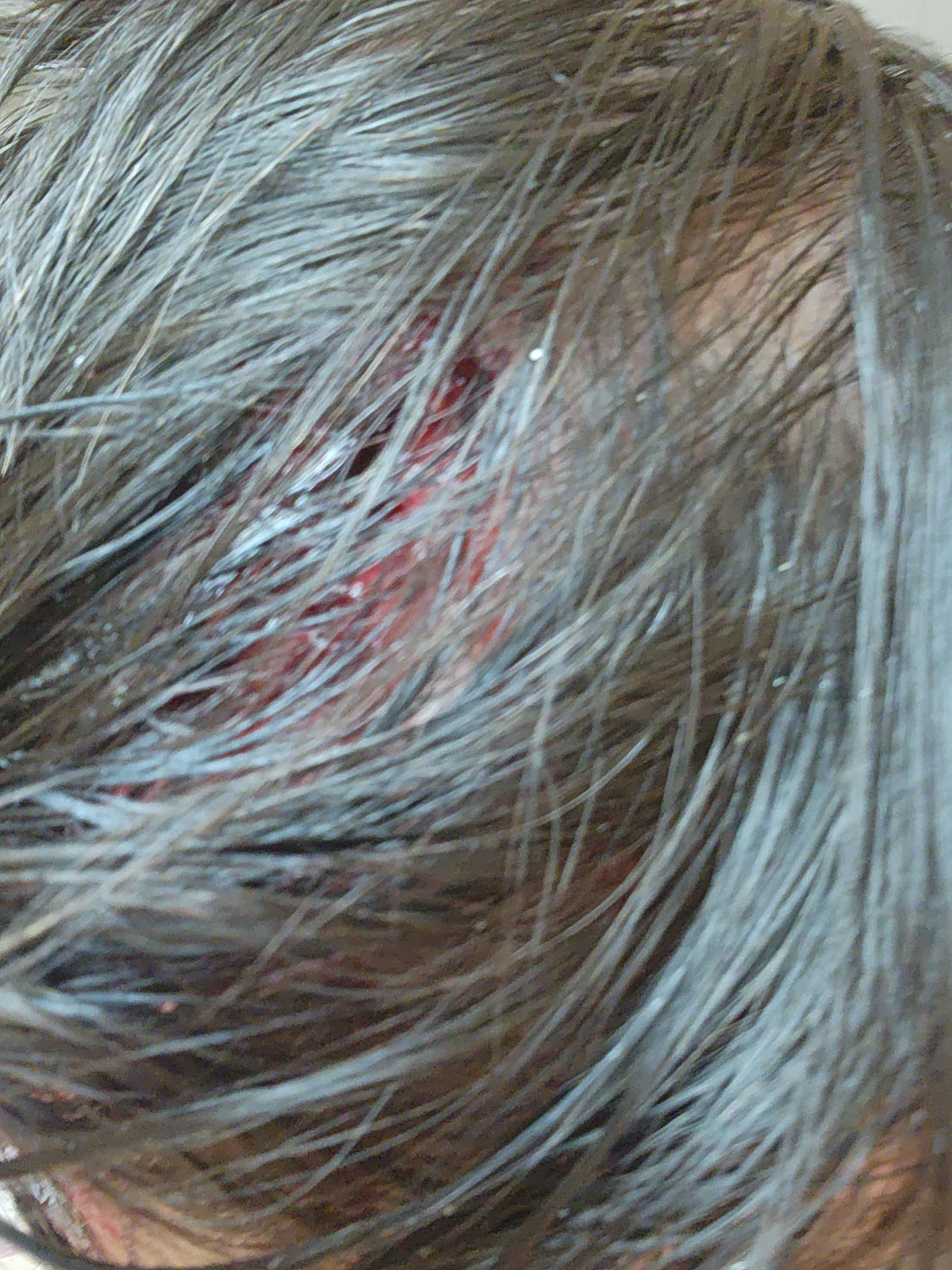 Support Our Urgent Needs After Car Accident campaign photo, 2 of 7