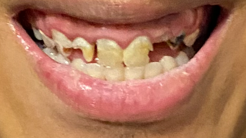 End tooth Pain: Support Dental Treatment photo