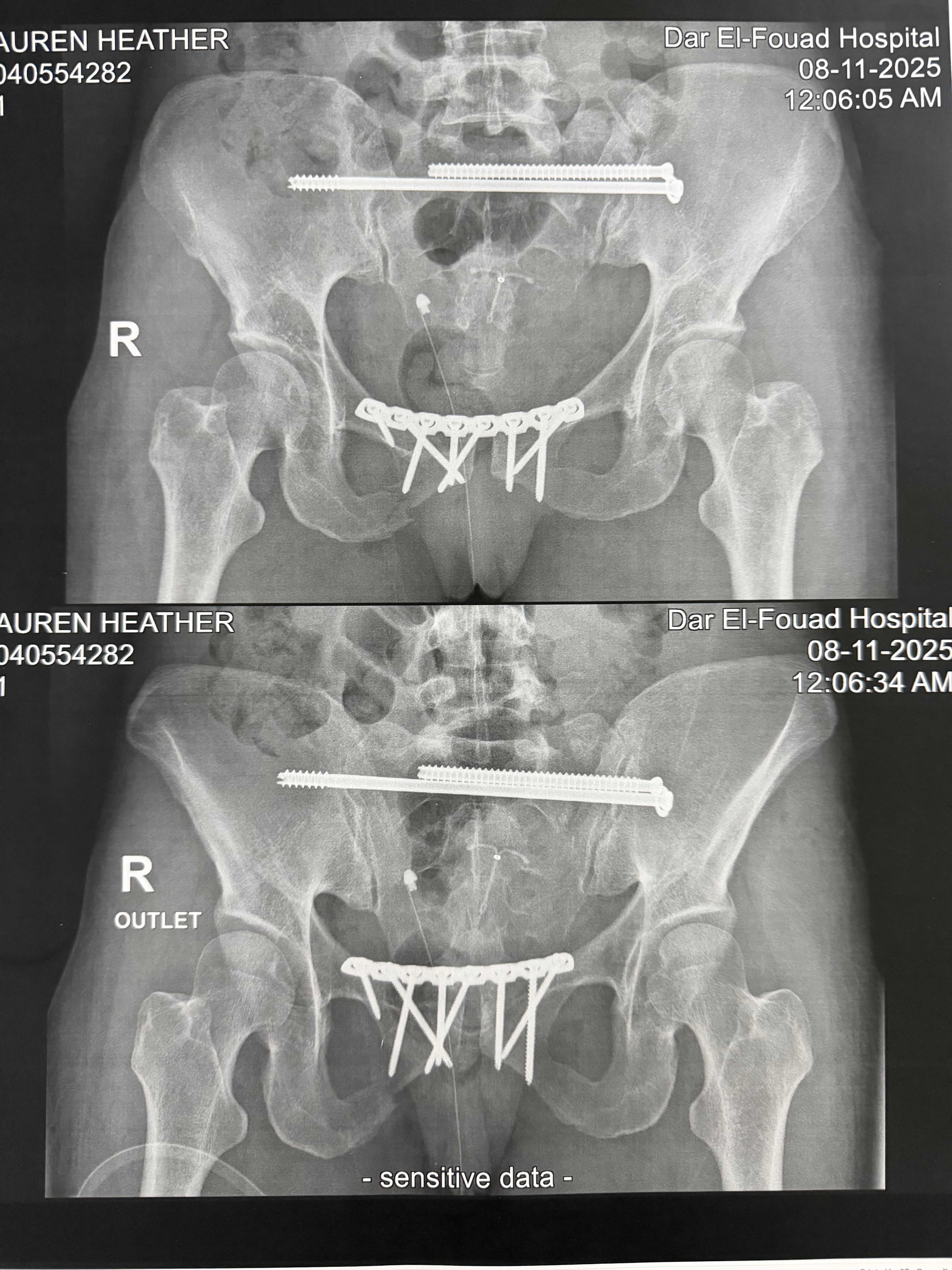 Support Lauren’s recovery after overseas sport accident campaign photo, 2 of 6