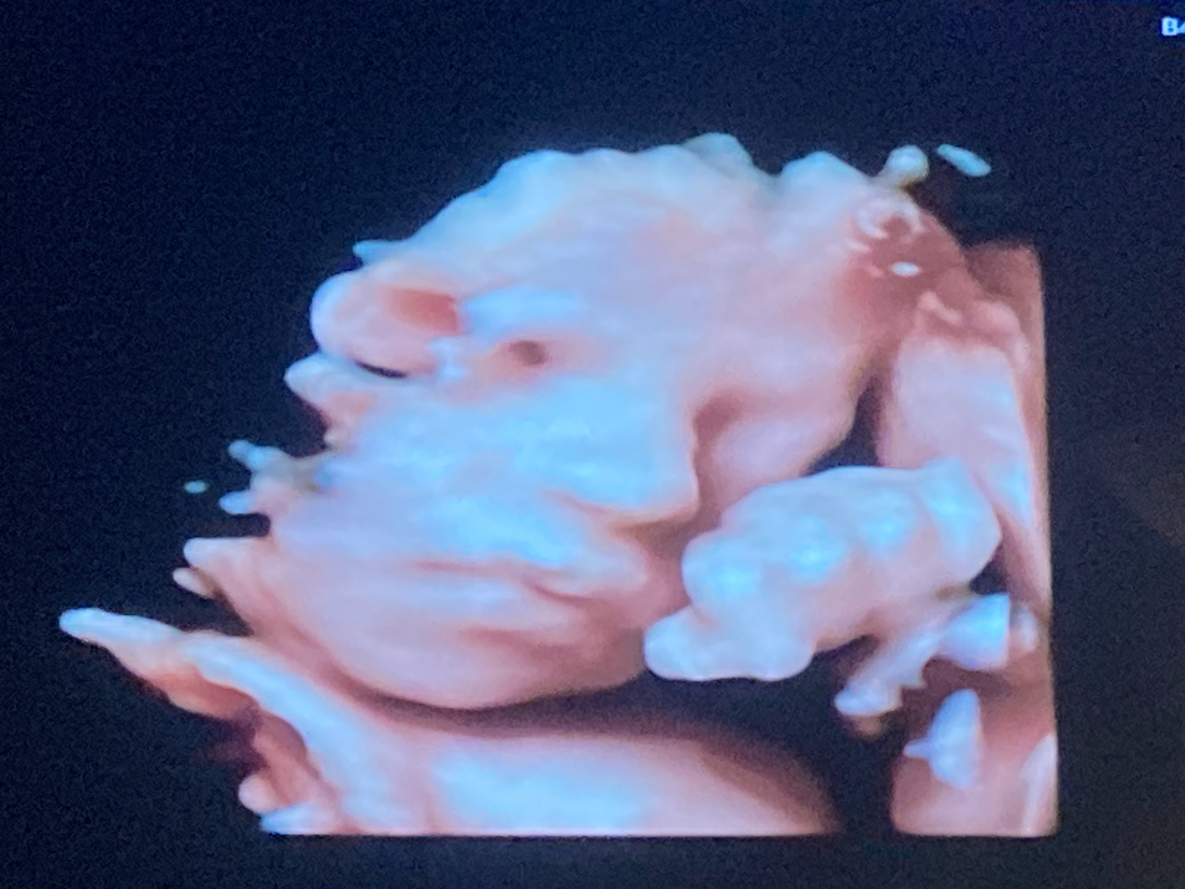 Isabel's Angels - Help Baby Isabel Live and Breathe campaign photo, 2 of 4