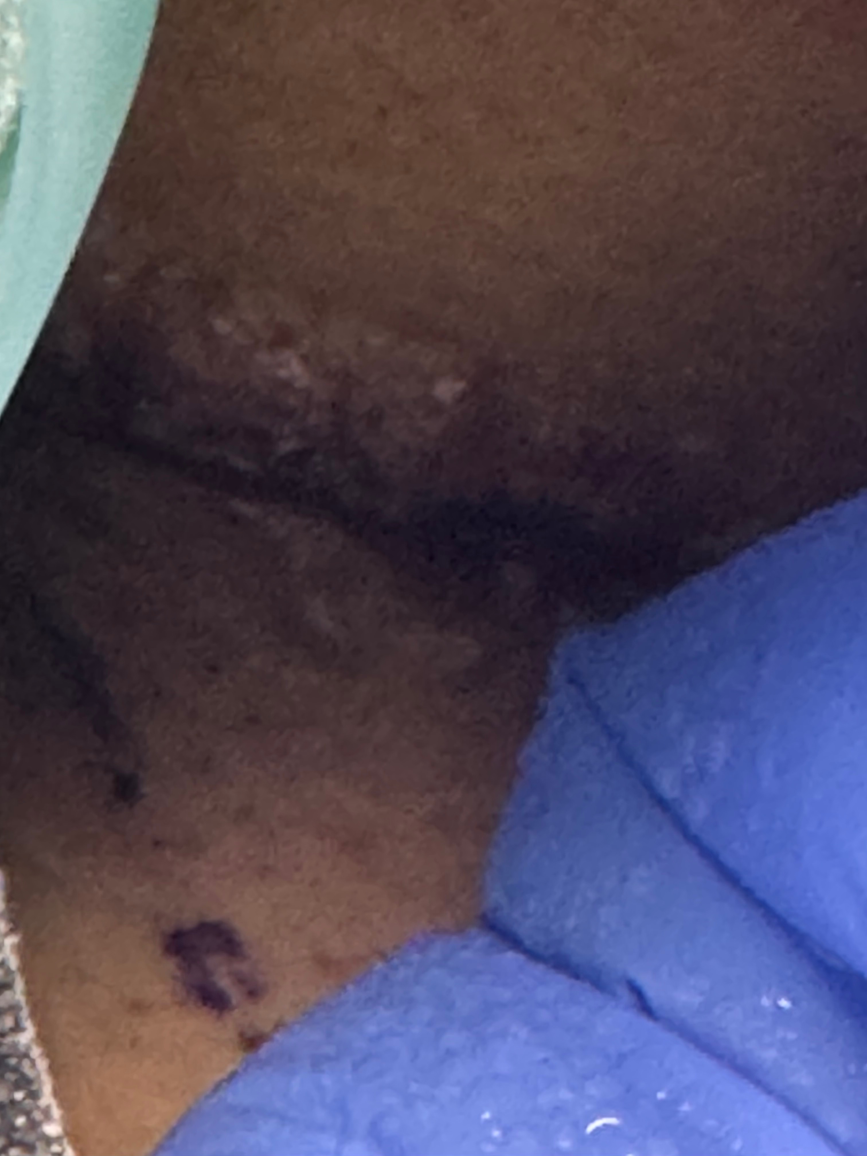 Urgent Surgery and Support Needed for Elvys campaign photo, 5 of 6