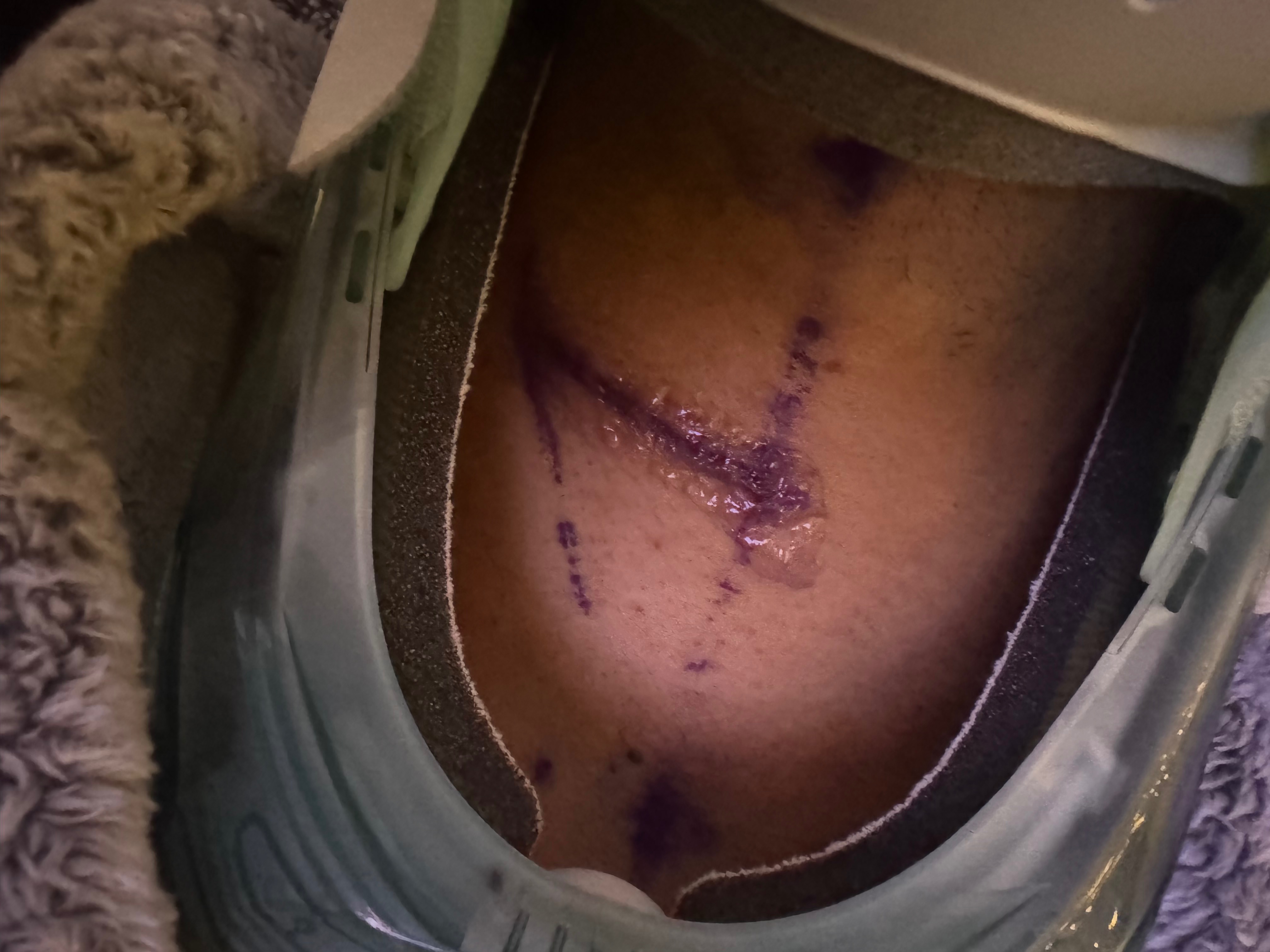 Urgent Surgery and Support Needed for Elvys campaign photo, 2 of 6