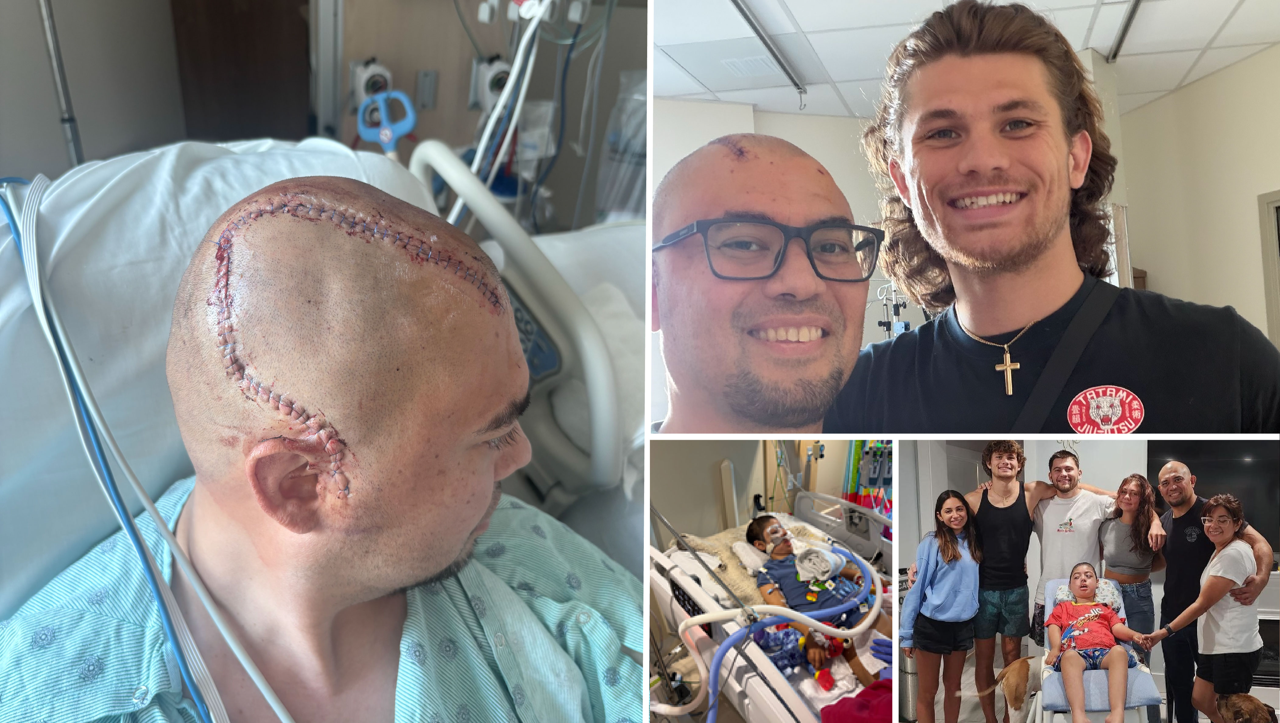 SUPPORT BRIAN CORN BATTLING LIFE-THREATENING BRAIN CANCER photo