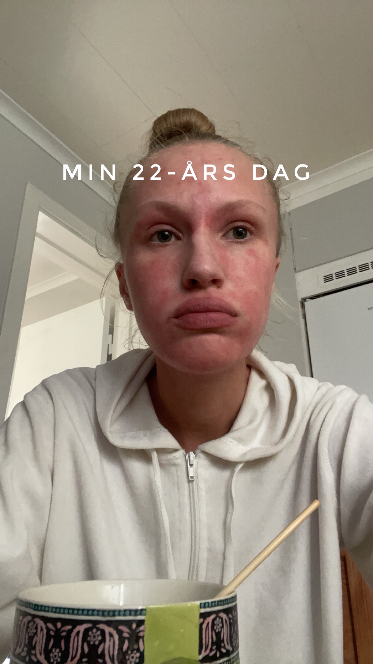 Help me fight TSW – and become myself again campaign photo, 6 of 7