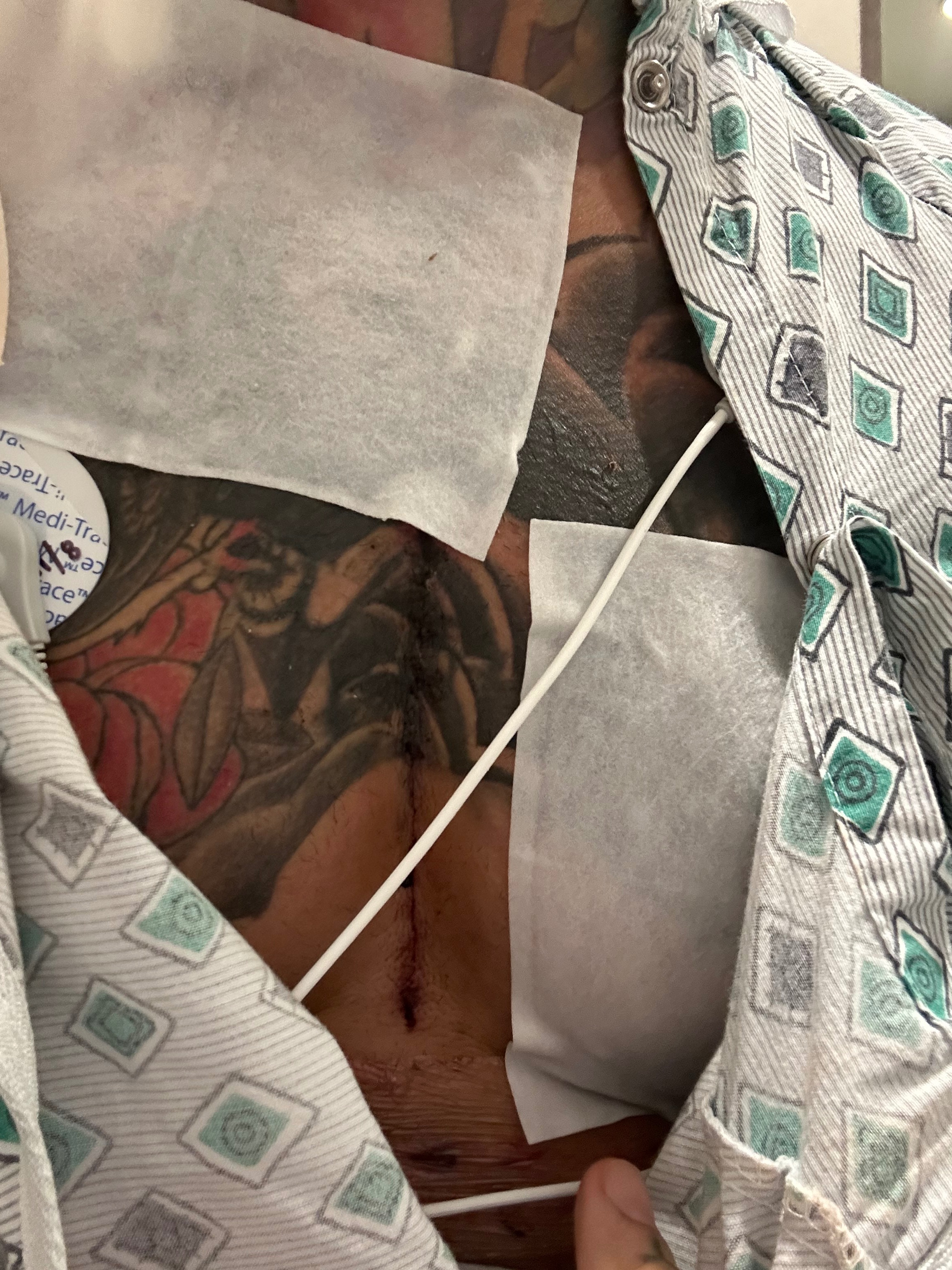 My RECOVERY. campaign photo, 2 of 8