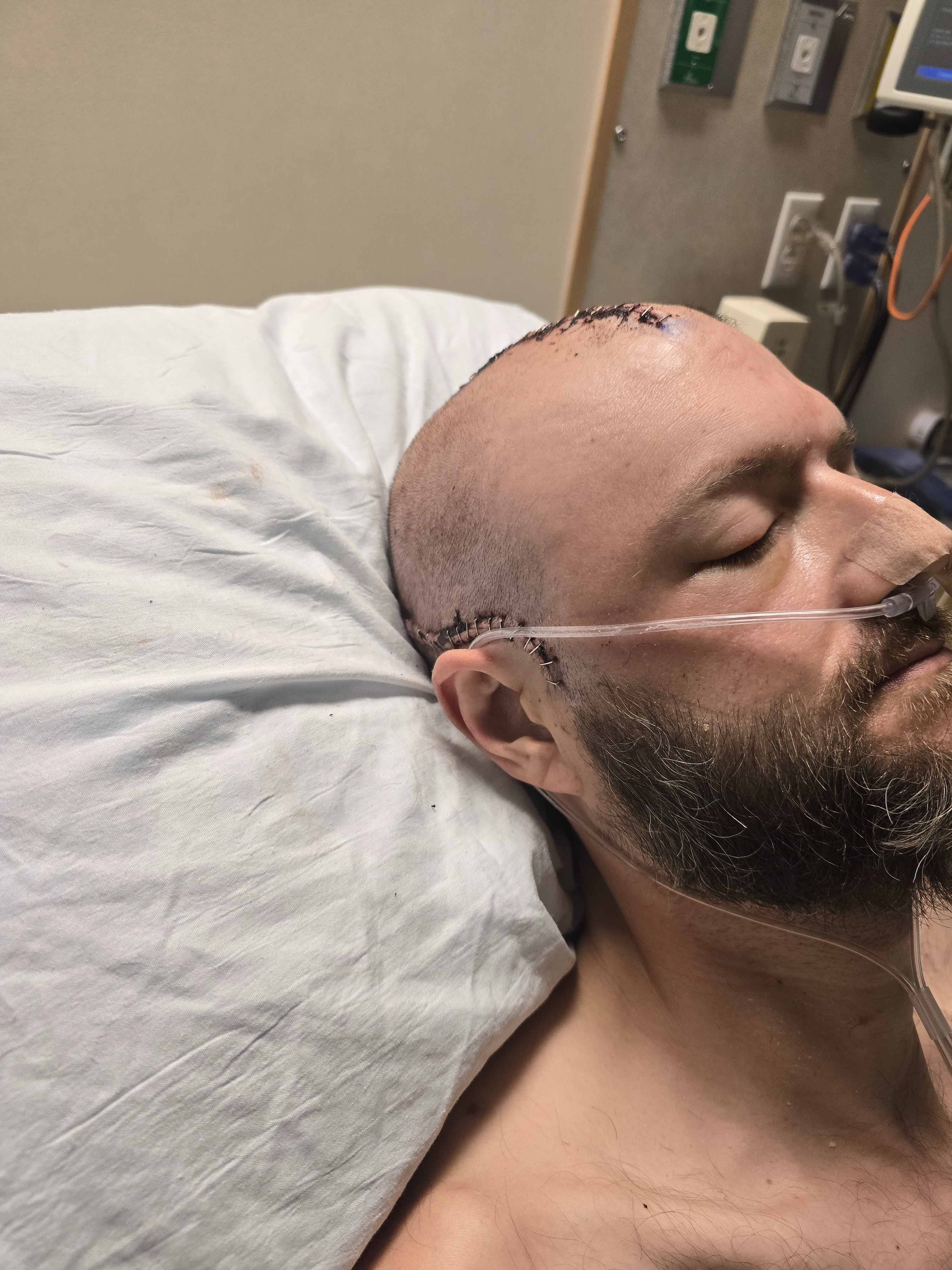 Support Adam's Recovery Journey campaign photo, 2 of 5