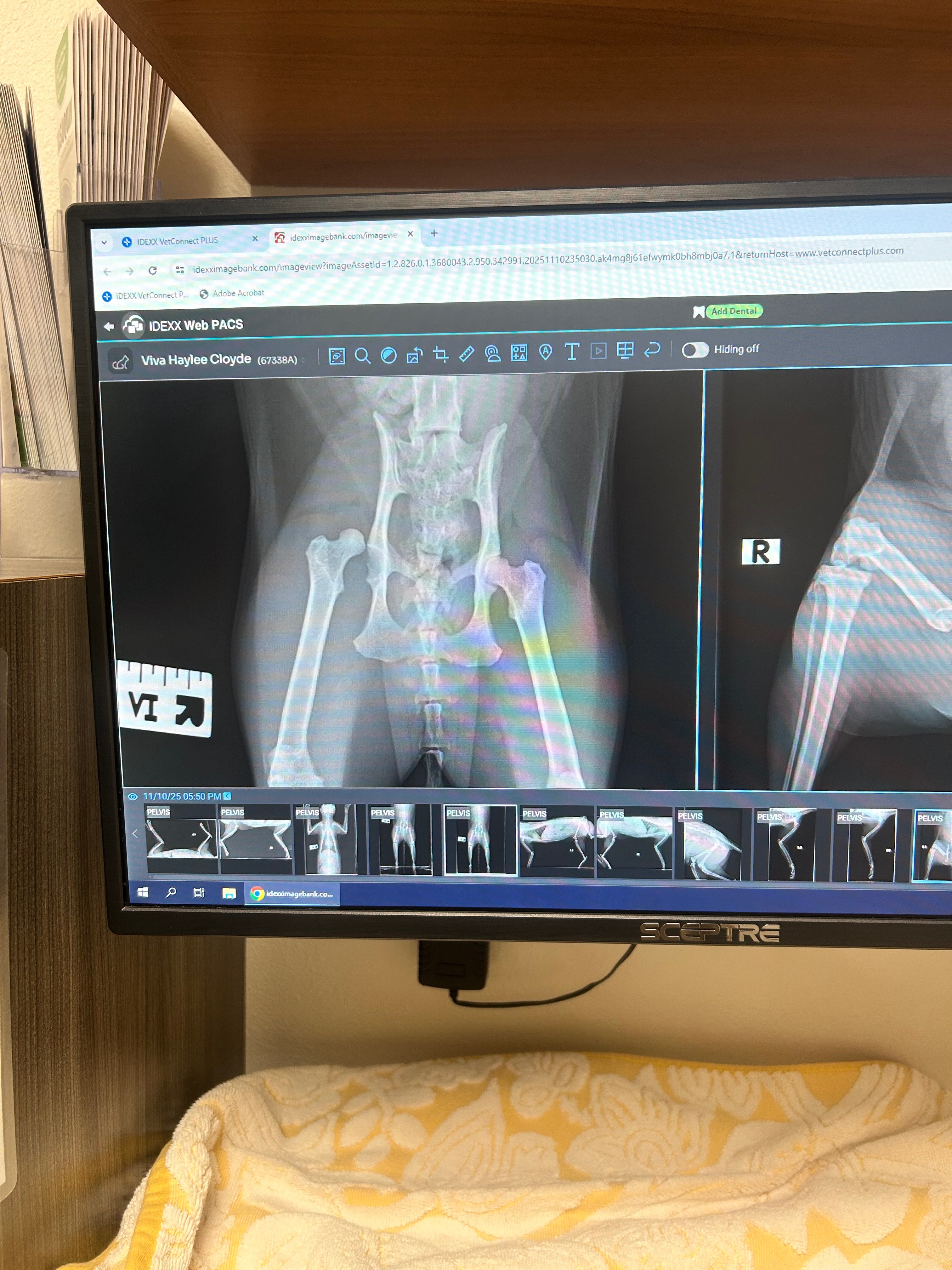 Help Viva after Her Accident — FHO Surgery Fun campaign photo, 2 of 8