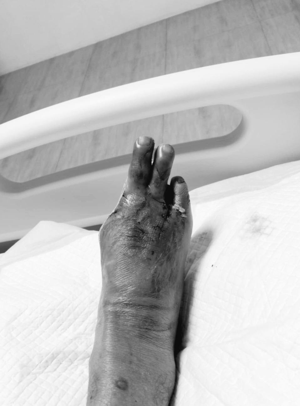 Help Lucilo Recover After Amputation campaign photo, 2 of 7