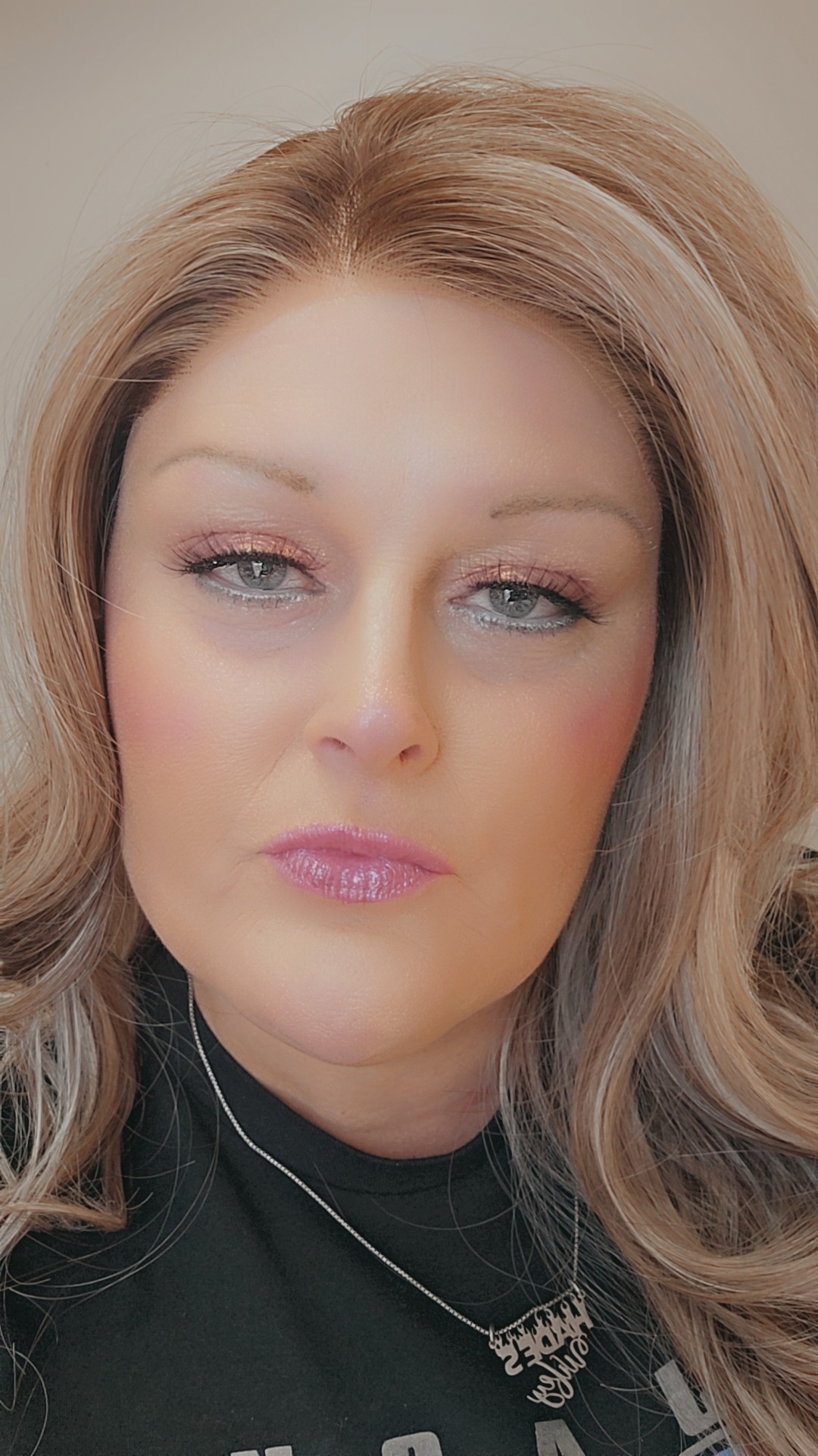 Help Melissa with Medical Costs and New Treatments for Lupus campaign photo, 2 of 8