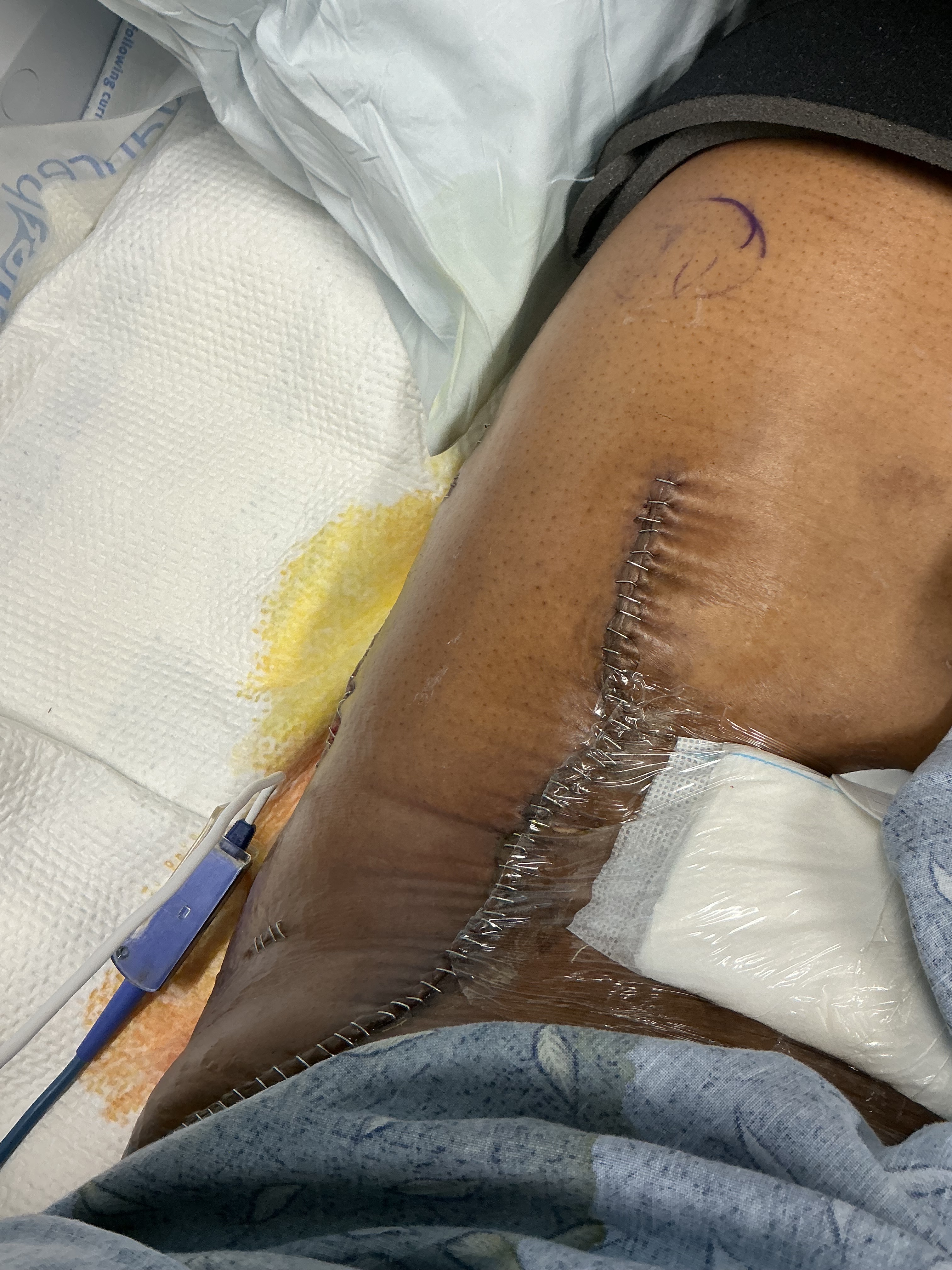Support Armanae On Her Road to Recovery campaign photo, 5 of 6