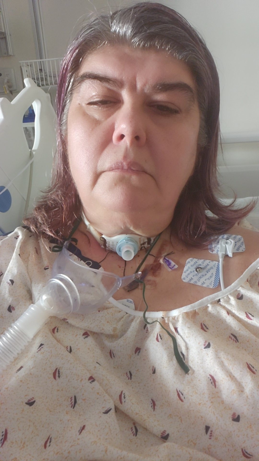 Help Kristi Breathe: Support Her Medical Needs campaign photo, 2 of 5