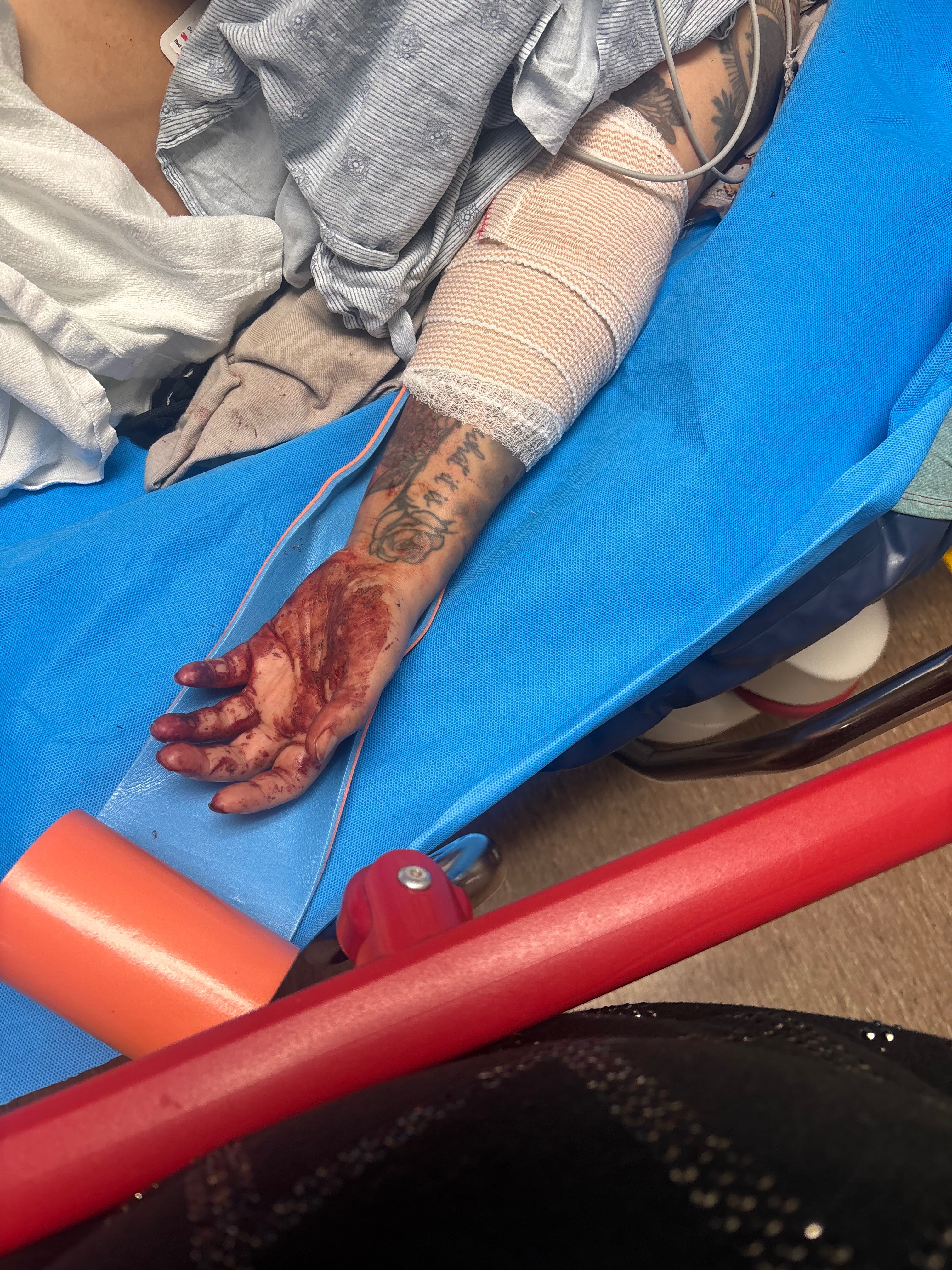Support Recovery After Traumatic Arm Injury campaign photo, 5 of 6