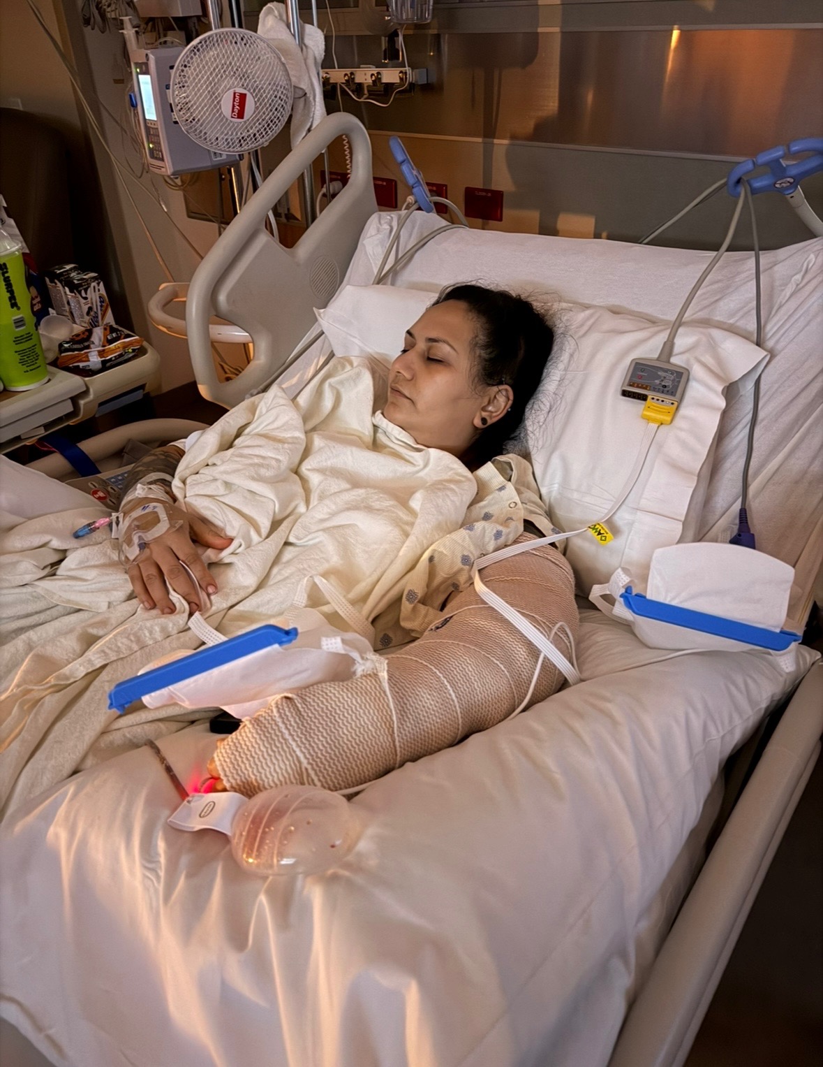 Support Recovery After Traumatic Arm Injury campaign photo, 4 of 6
