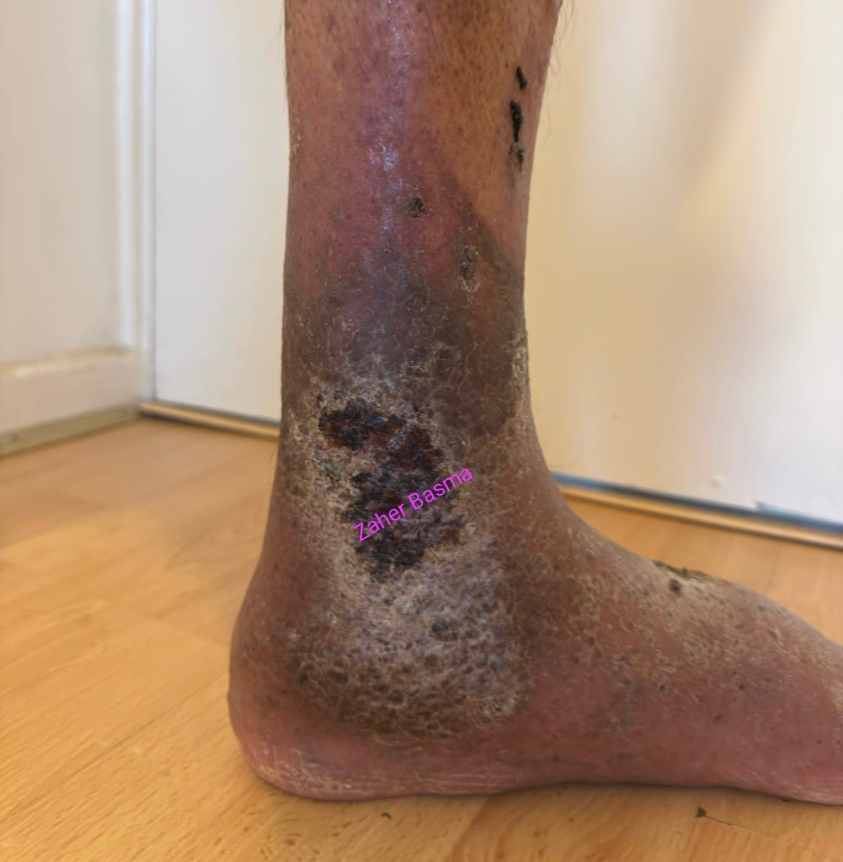 Please help Zaher with urgent medical fees campaign photo, 4 of 5