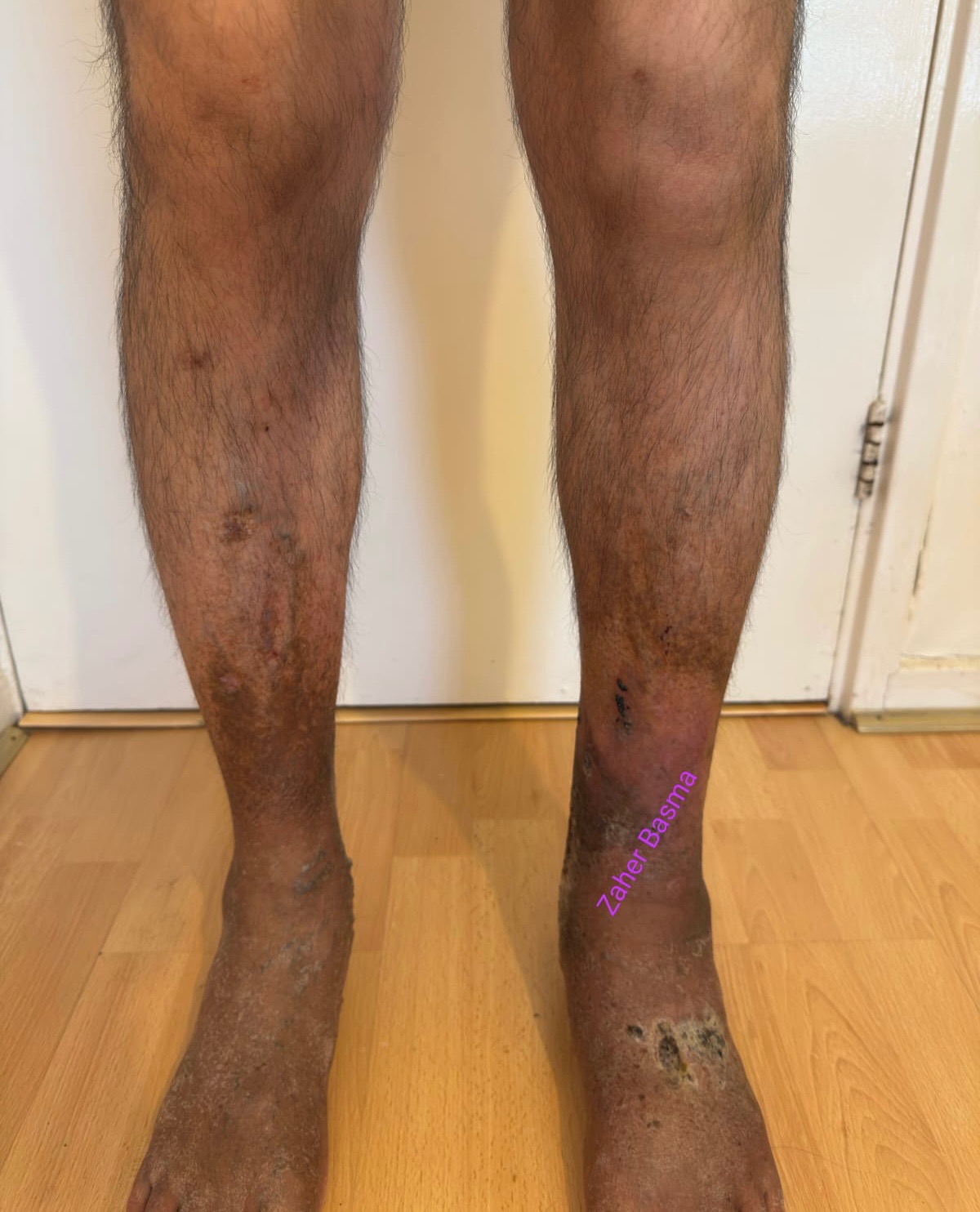Please help Zaher with urgent medical fees campaign photo, 2 of 5