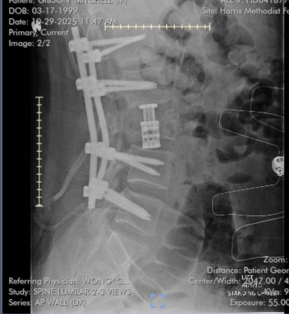 Support Mitchell Hunter Gibson II's Recovery Journey campaign photo, 5 of 8