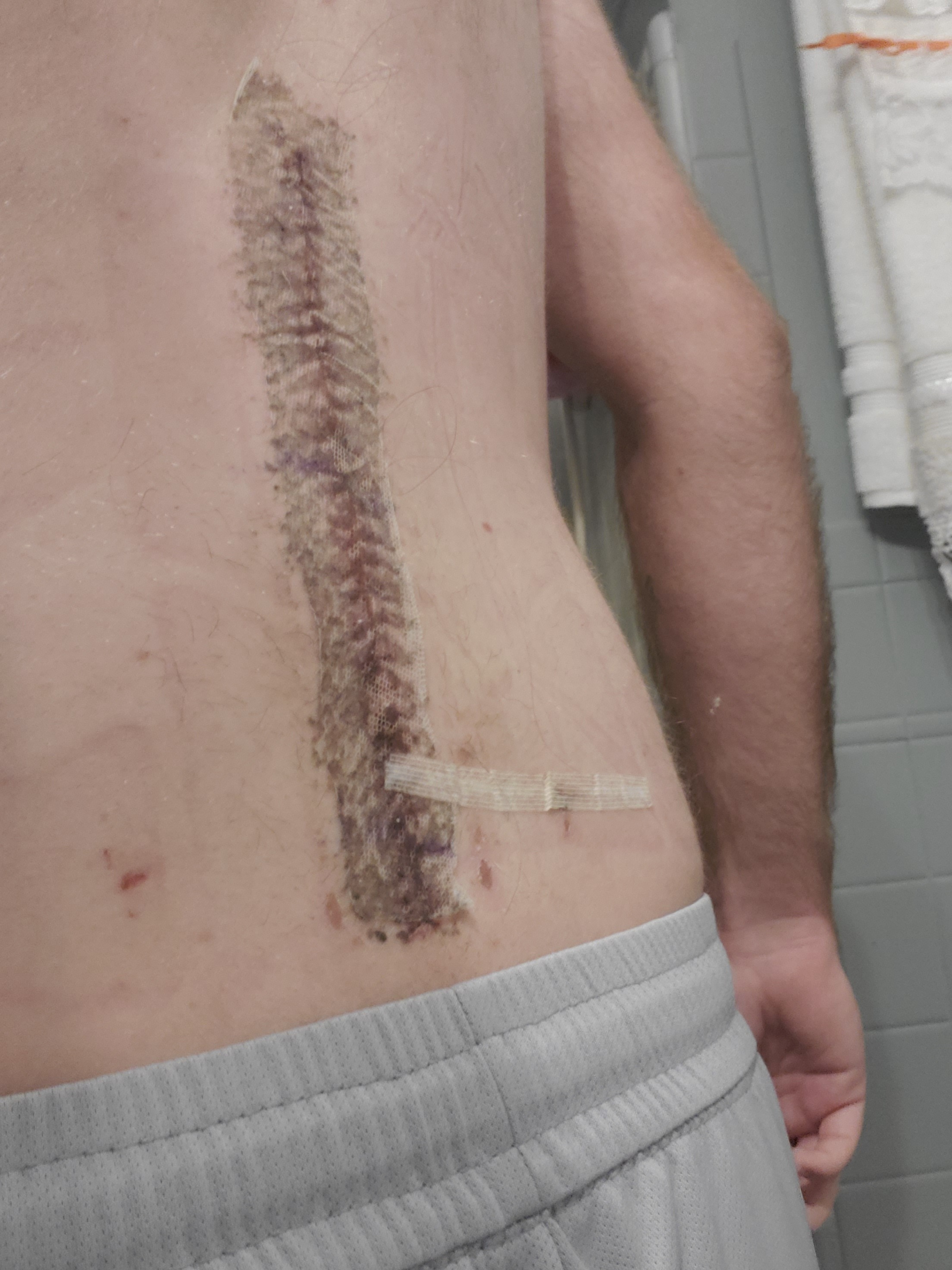 Support Mitchell Hunter Gibson II's Recovery Journey campaign photo, 6 of 8