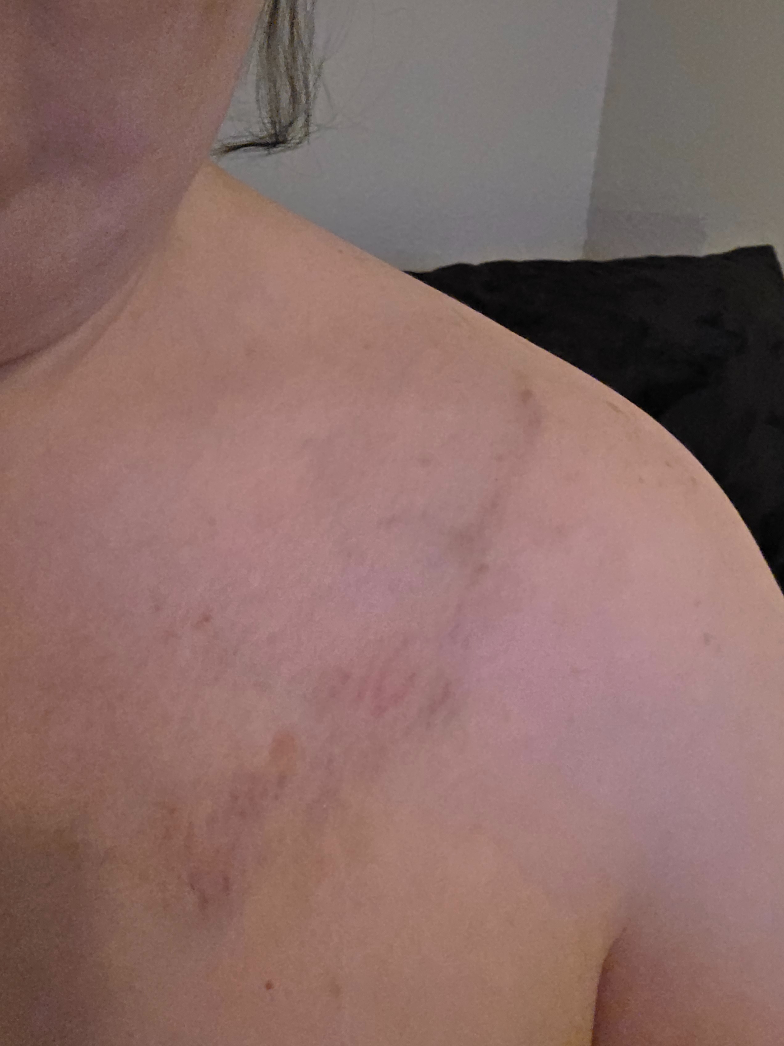 Support Needed After Severe Car Accident campaign photo, 4 of 8